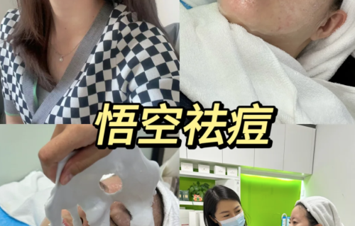 悟空祛痘的祛痘效果怎么样？