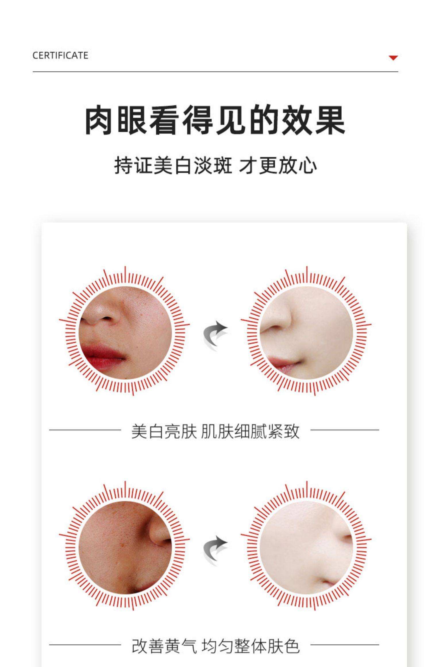 怎么美白祛斑(怎样祛斑美白最快最有效的方法)