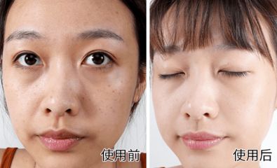 祛斑哪里好(安康祛斑哪里好)