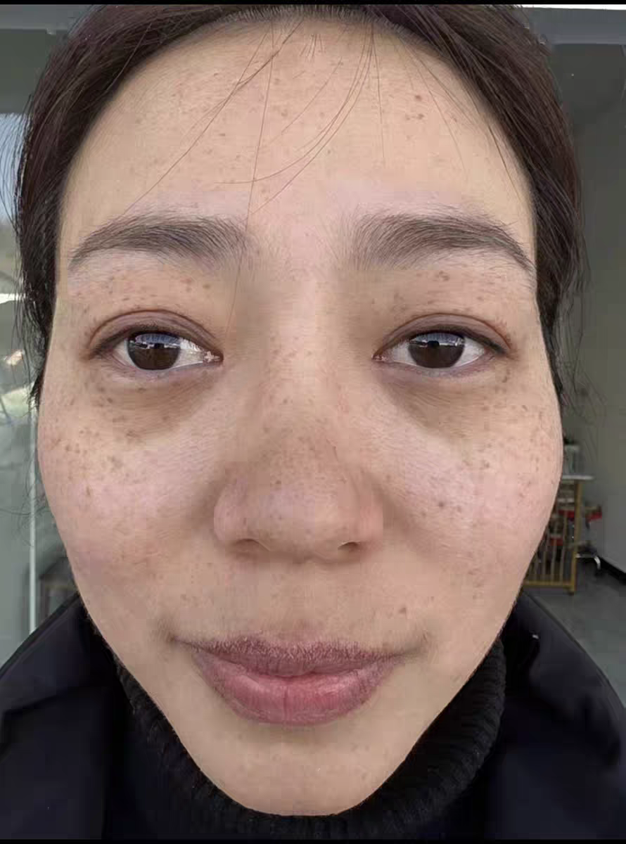 皮肤美白祛斑(皮肤美白祛斑霜有用吗)