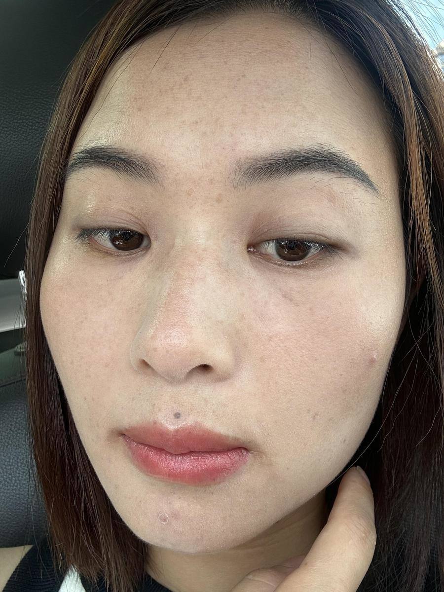 皮肤美白祛斑(皮肤美白祛斑霜有用吗)