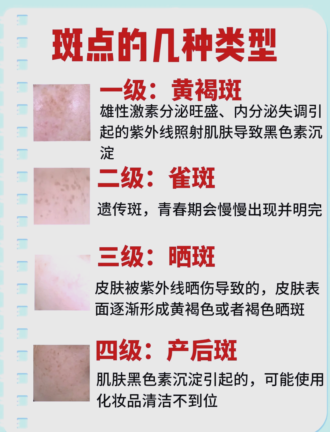 蜂蜜祛斑法(蜂蜜去斑怎么用)