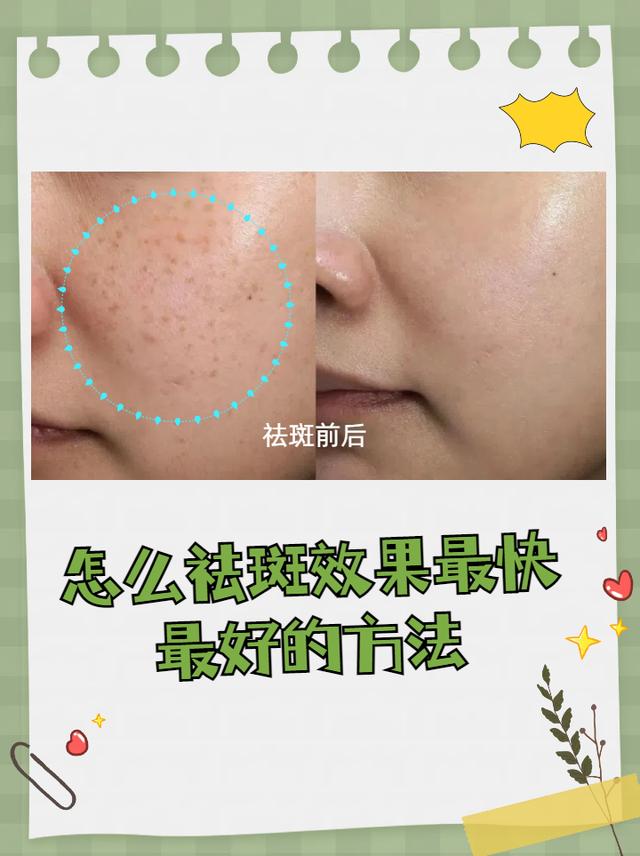 怎么祛斑效果最快最好的方法的简单介绍