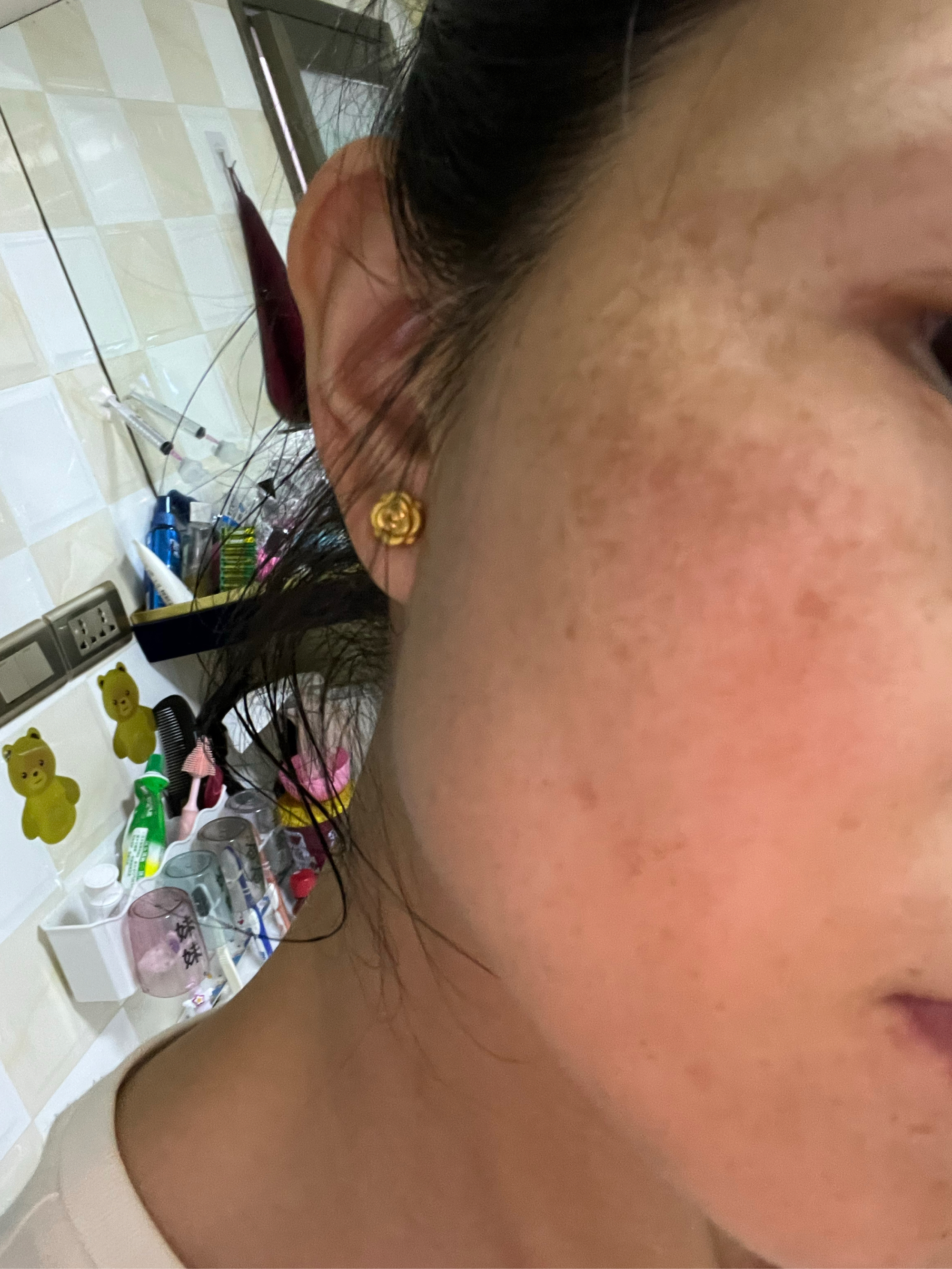 中药祛斑(中药祛斑面膜的配方有哪些)