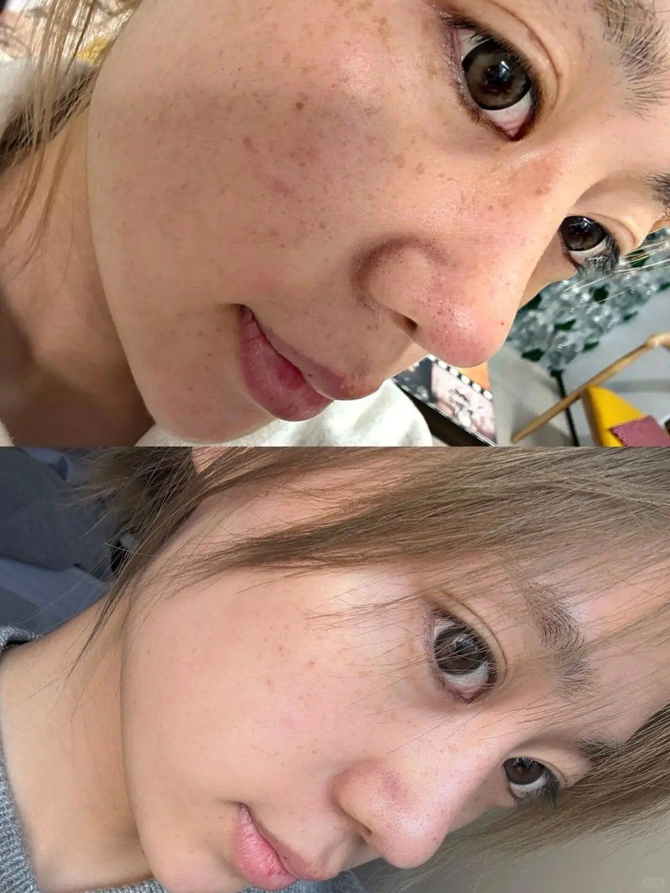 祛斑(祛斑效果最好的排名第一)