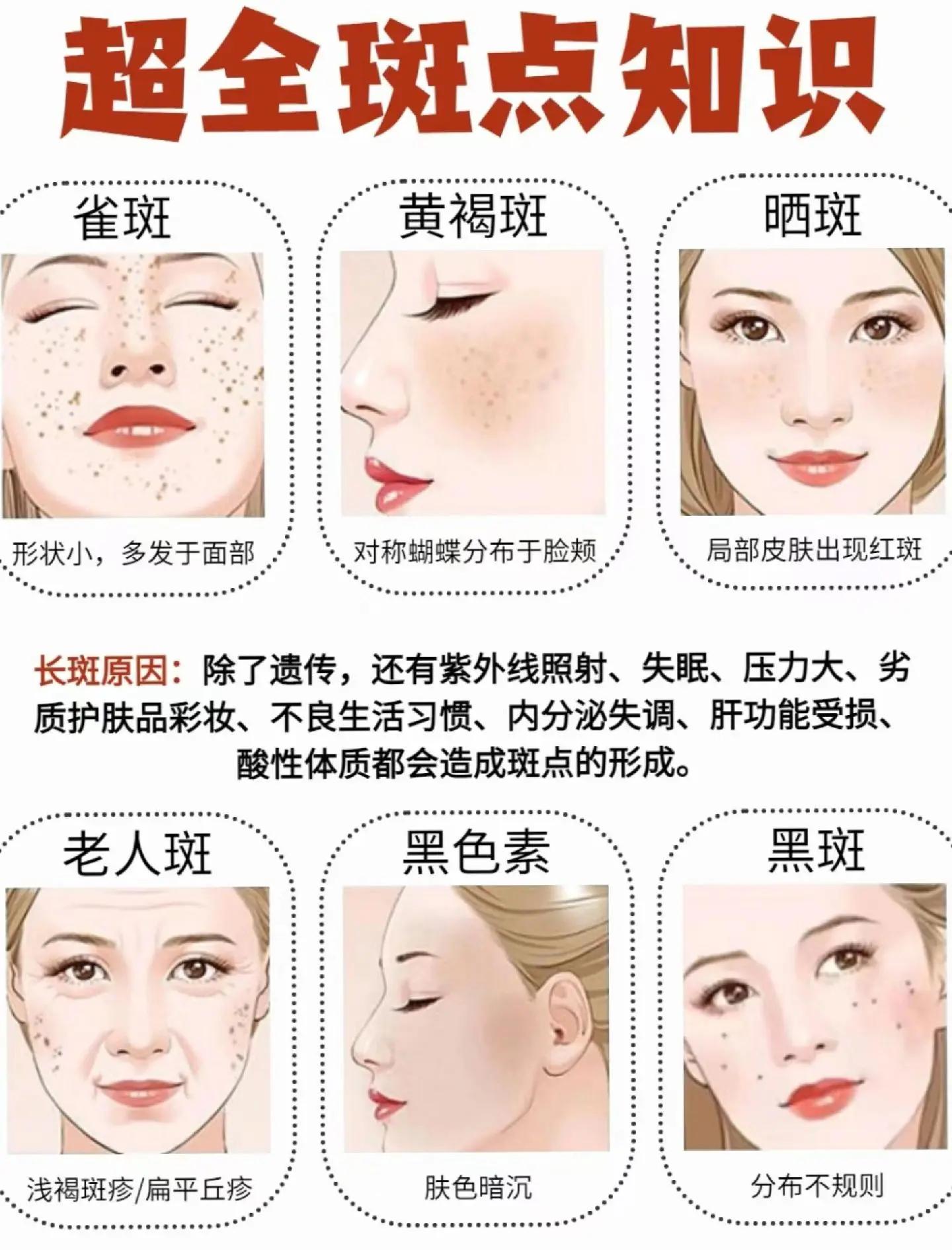 祛斑妙招(祛斑妙招绝招第一名)