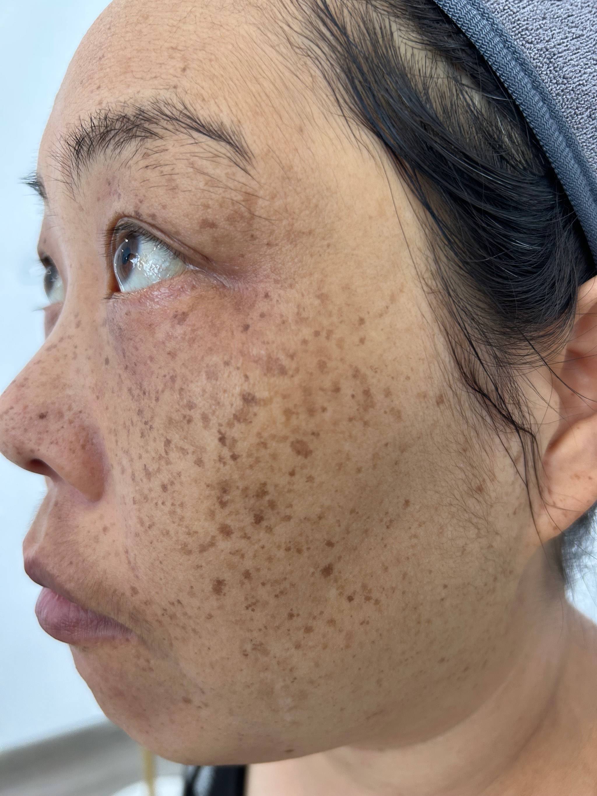 医院皮肤科可以祛斑吗(医院皮肤科能治疗脸上的斑吗)