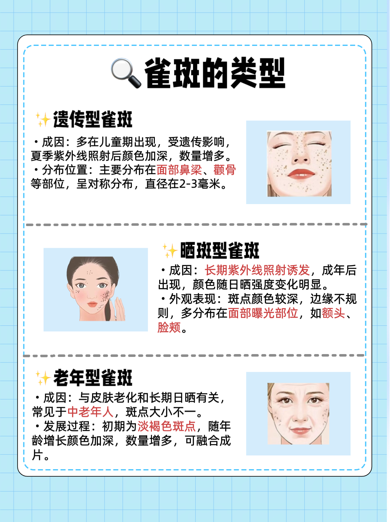 激光祛斑后注意事项(打了激光祛斑后注意事项)