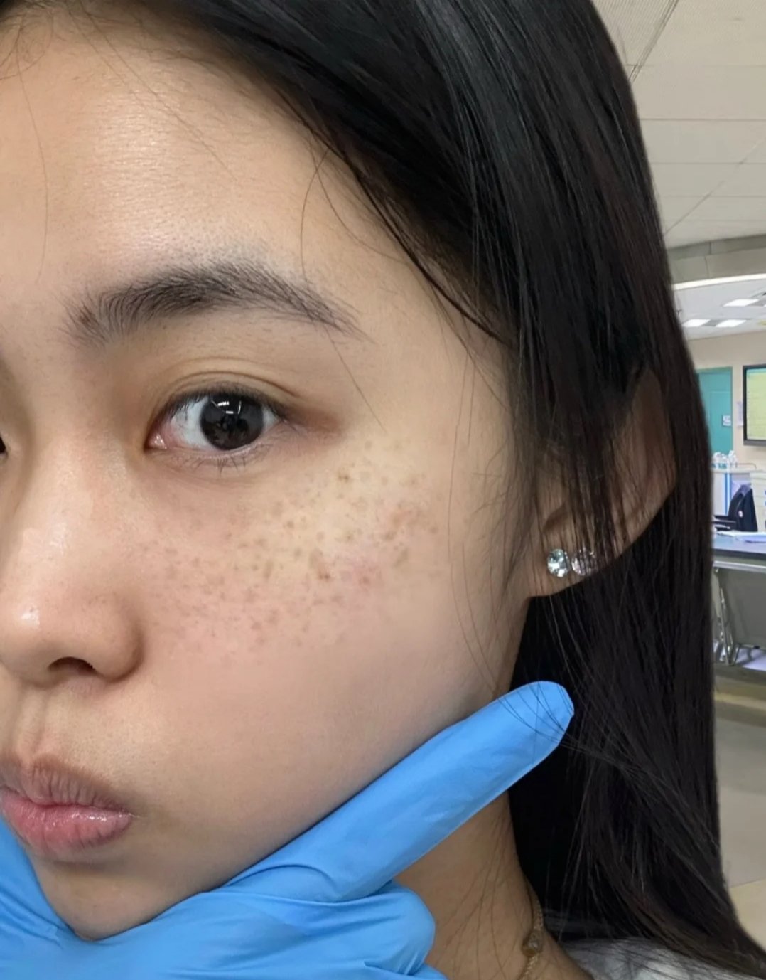 怎样祛斑(怎样祛斑淡斑效果最好)