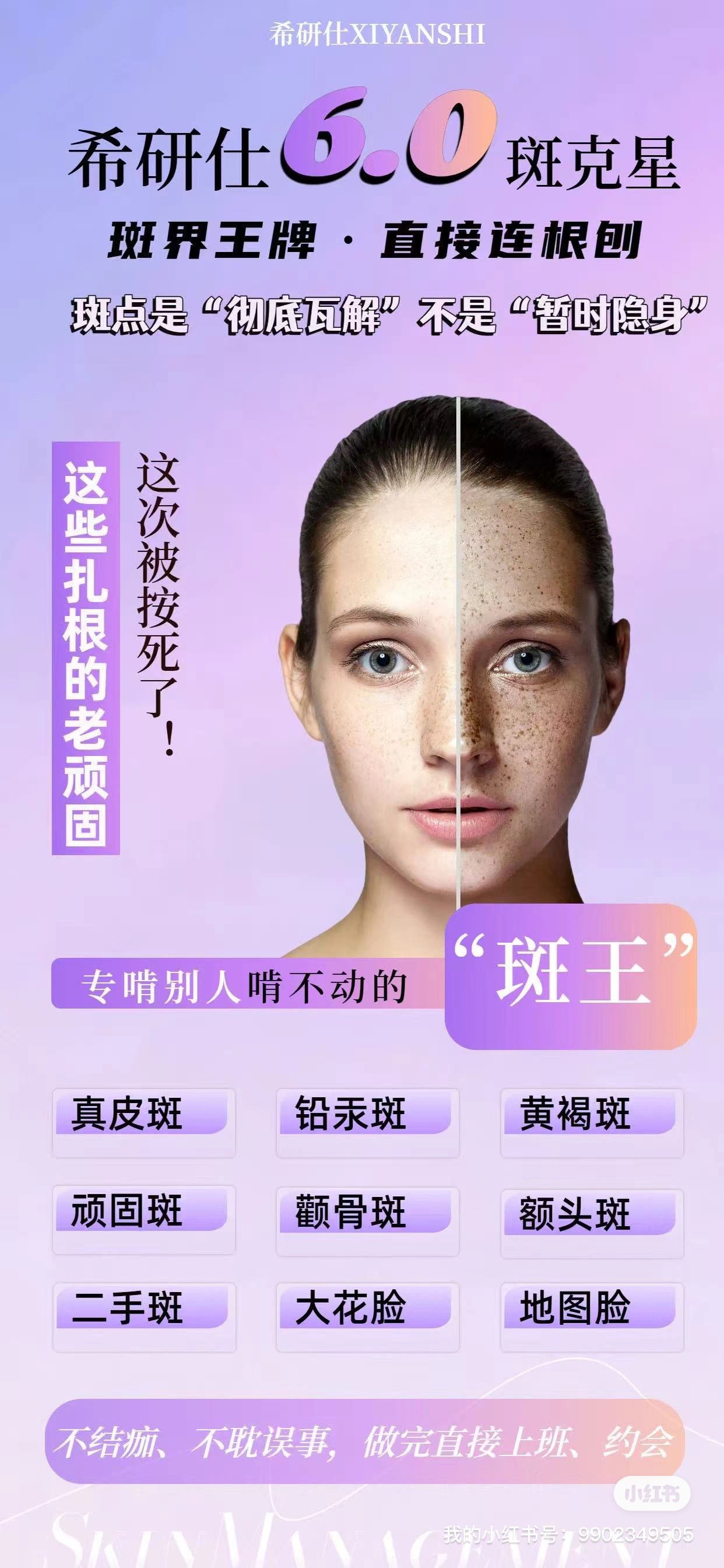 祛斑哪家好(祛斑效果哪家强)