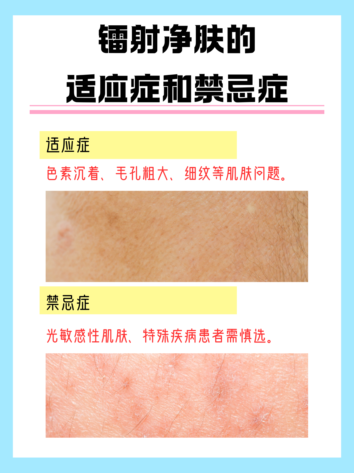 镭射祛斑效果及副作用(镭射祛斑效果及副作用图片)