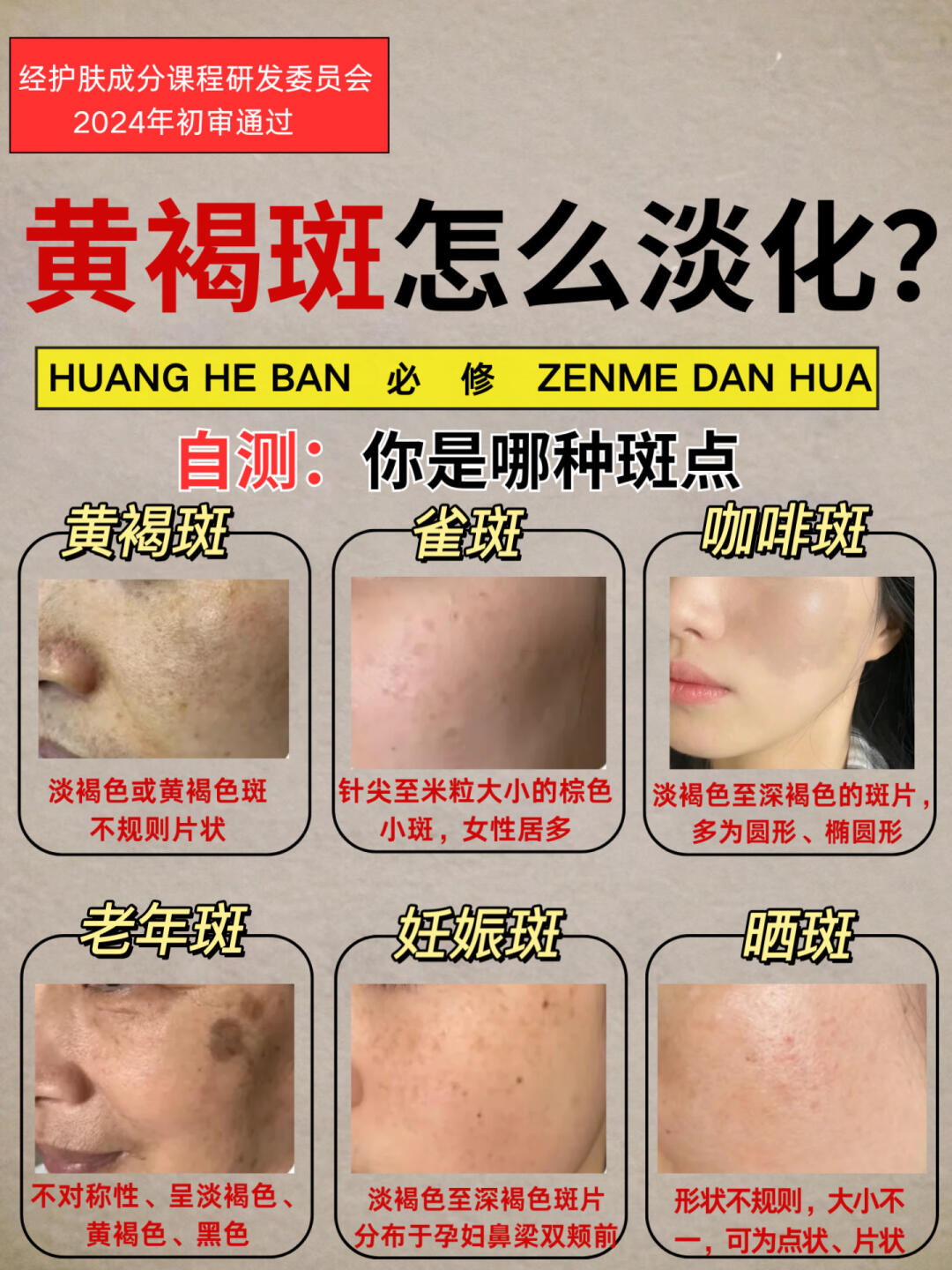 怎样祛斑最好最有效的方法(怎样祛斑最好最有效的方法视频)