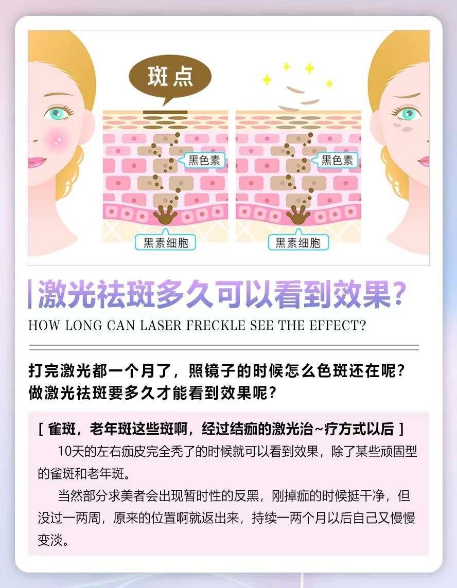 祛斑后多久可以洗脸(祛斑后多久可以洗脸化妆)