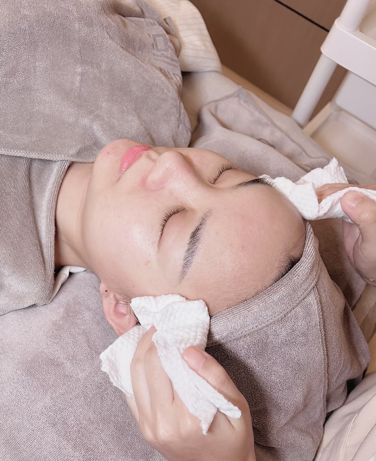 祛斑后多久可以洗脸(祛斑后多久可以洗脸化妆)