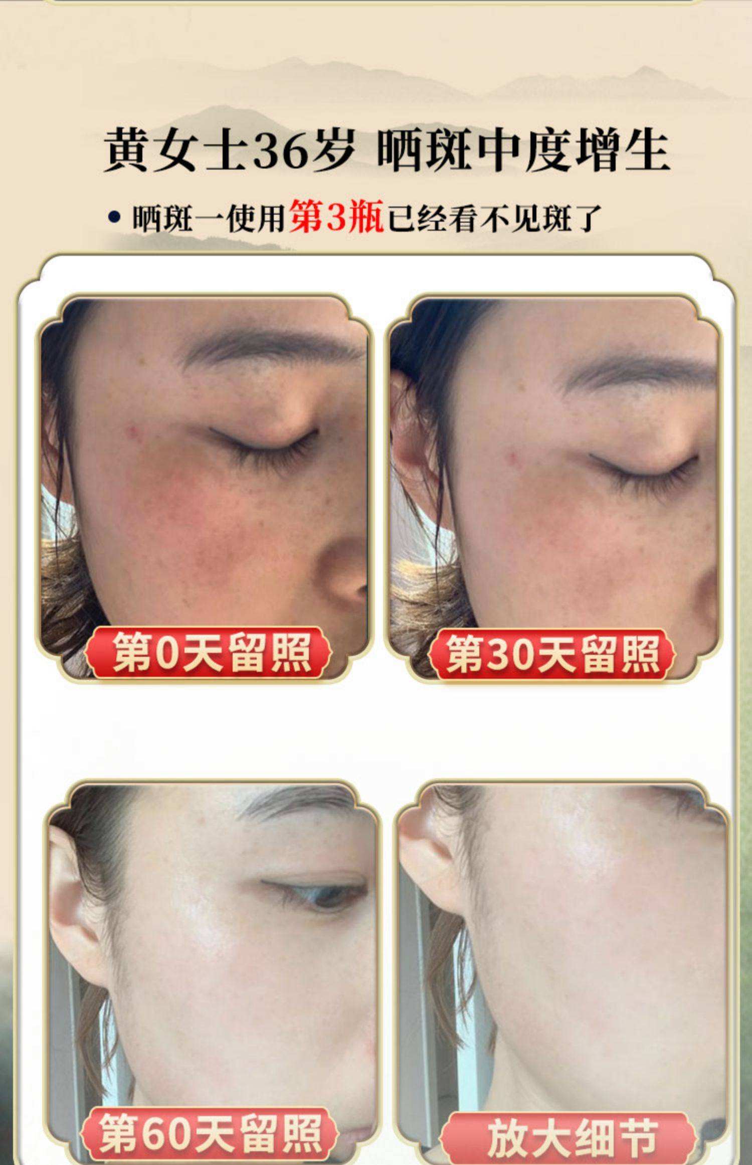 祛斑美白(祛斑美白的中药材有哪些)