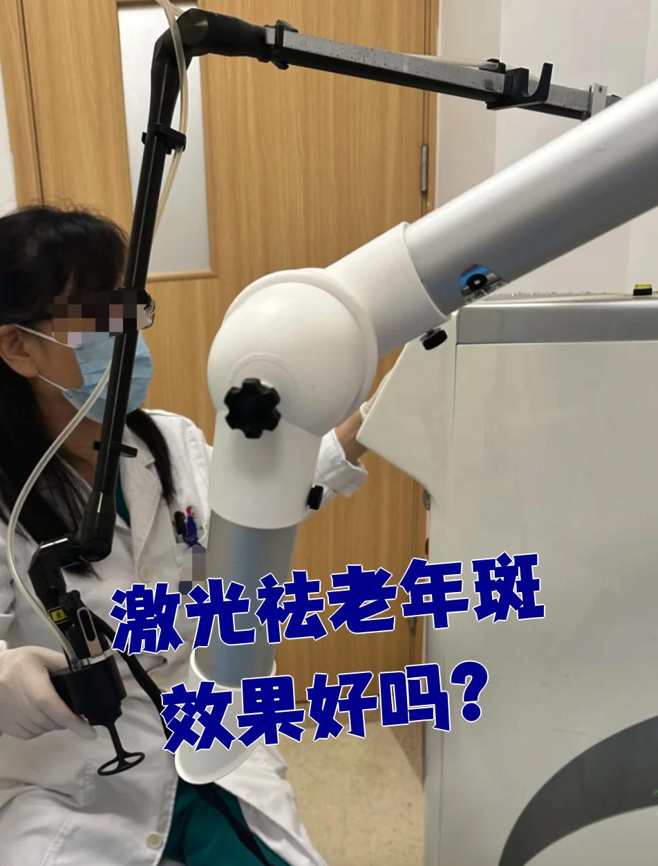 激光祛老年斑(激光祛老年斑的一般价格)