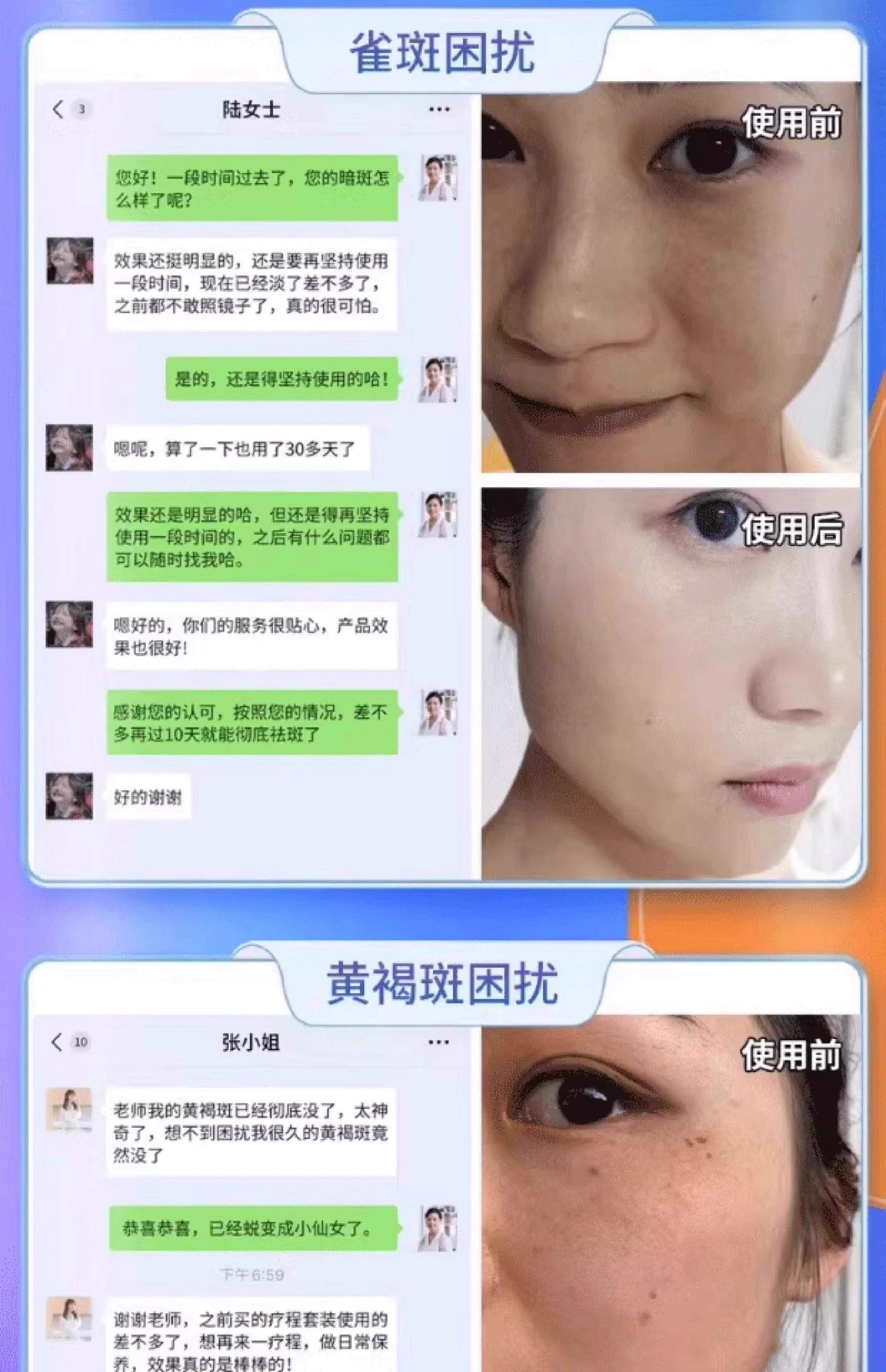 皮肤祛斑多少钱(祛斑美肤要多少钱)