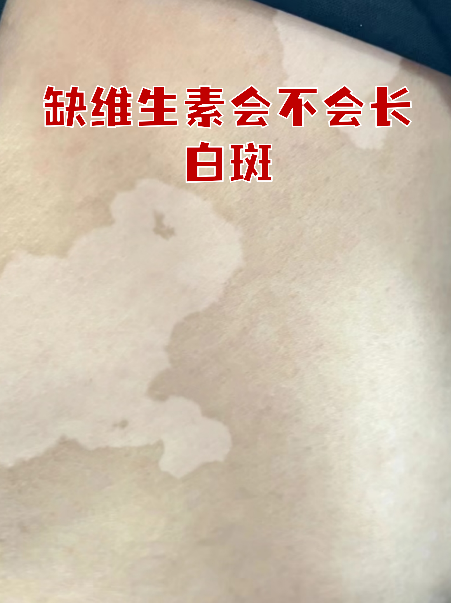 维生素c能美白祛斑吗(淡斑吃什么维生素能祛斑)