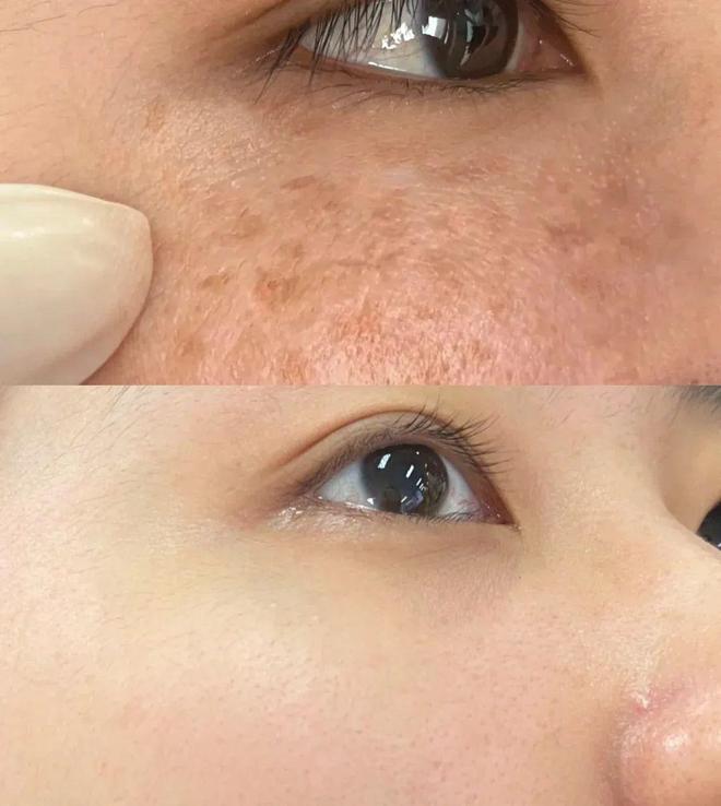 片仔癀祛斑(片仔癀祛斑霜)