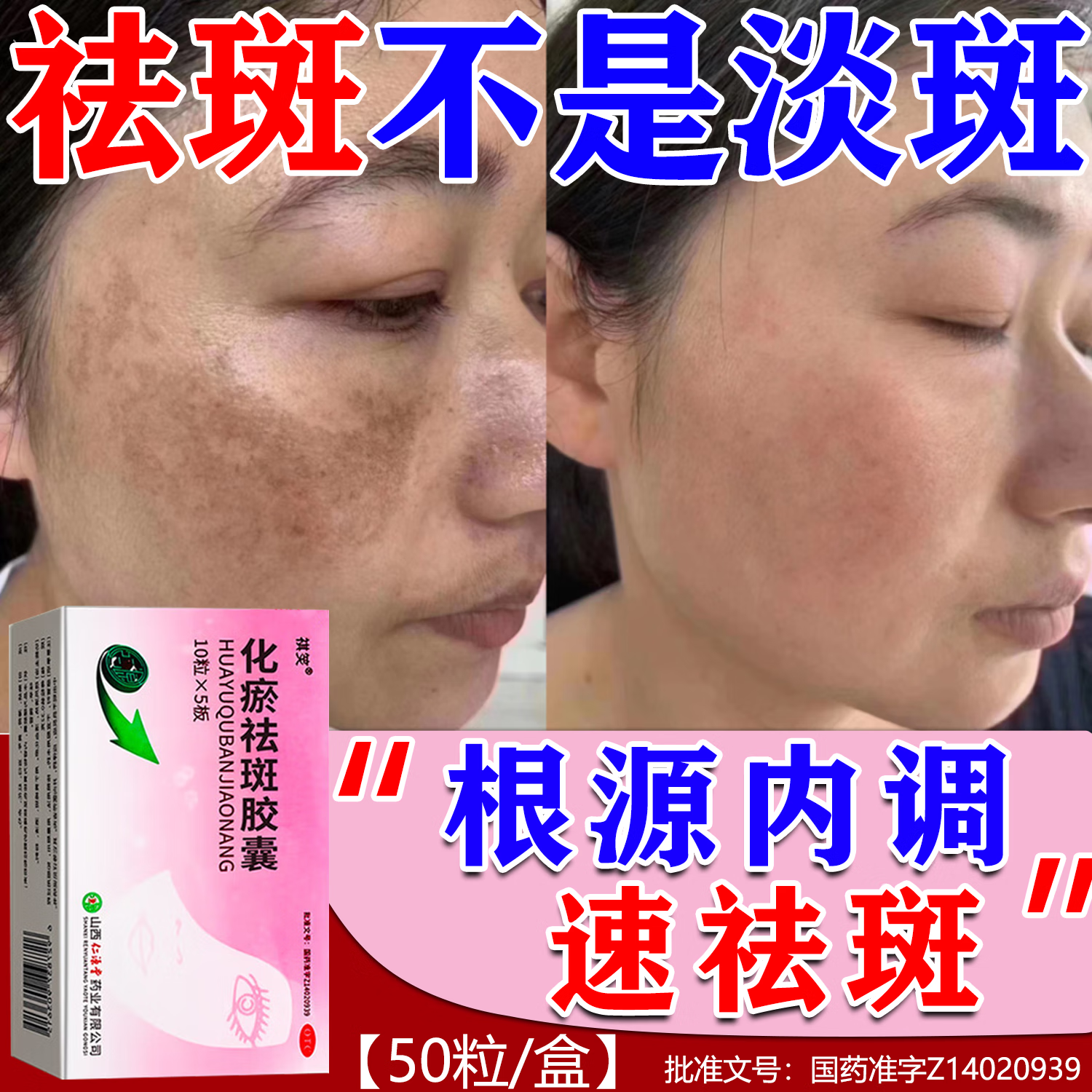 祛斑胶囊(祛斑胶囊效果最好的排名第一)