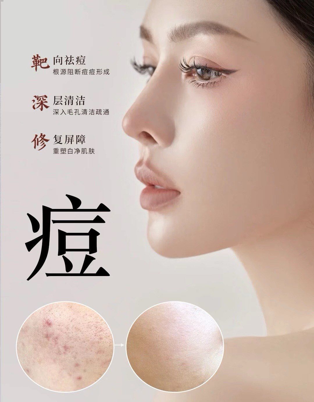 专业祛斑祛痘(专业祛斑祛痘连锁店排行榜)