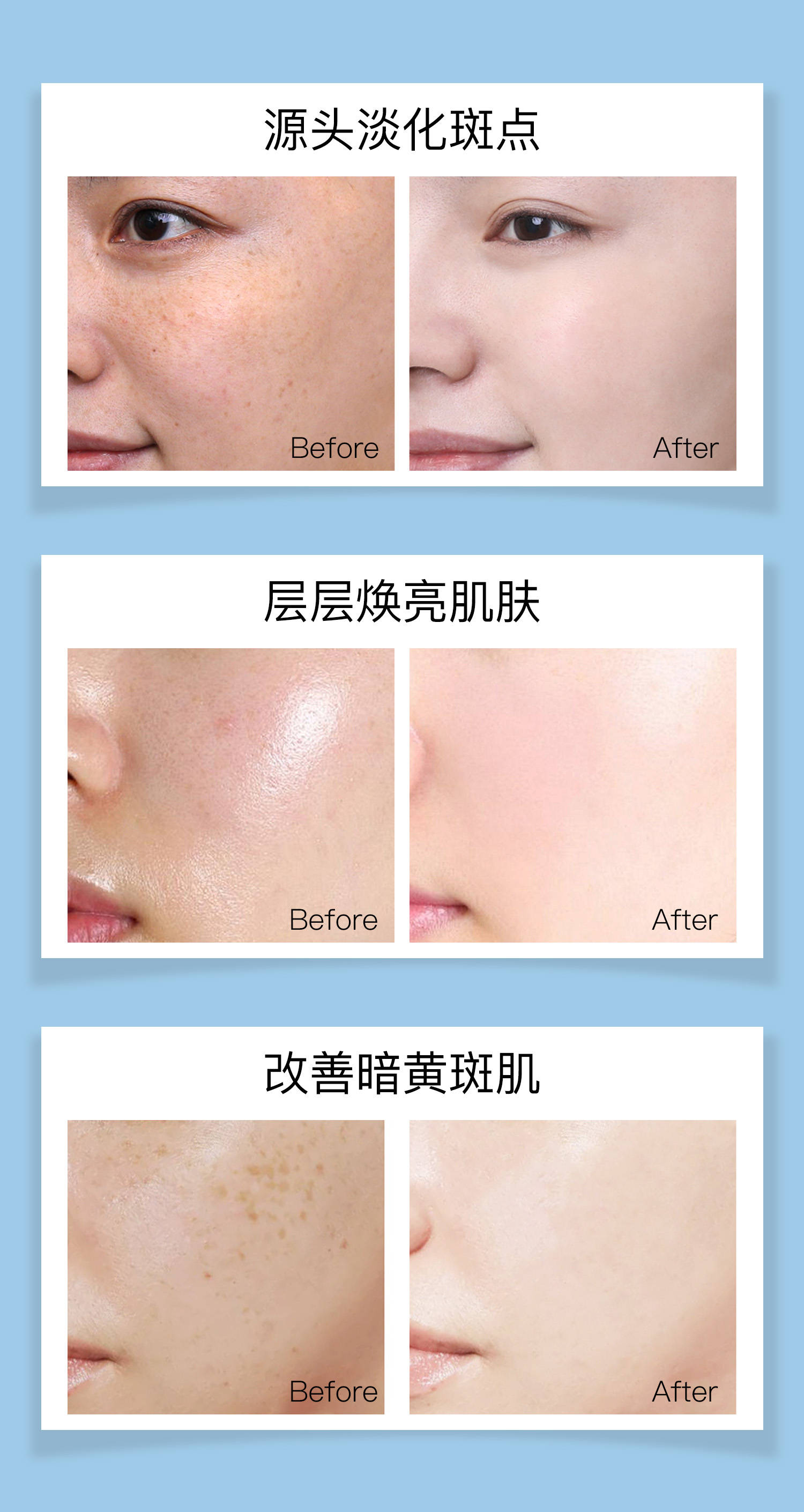 祛斑产品排行榜10强(真正有效的祛斑产品排行榜10强)