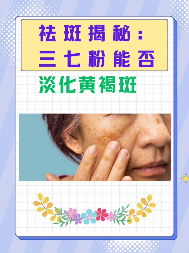 怎样治祛斑(怎祛斑彻底有效)