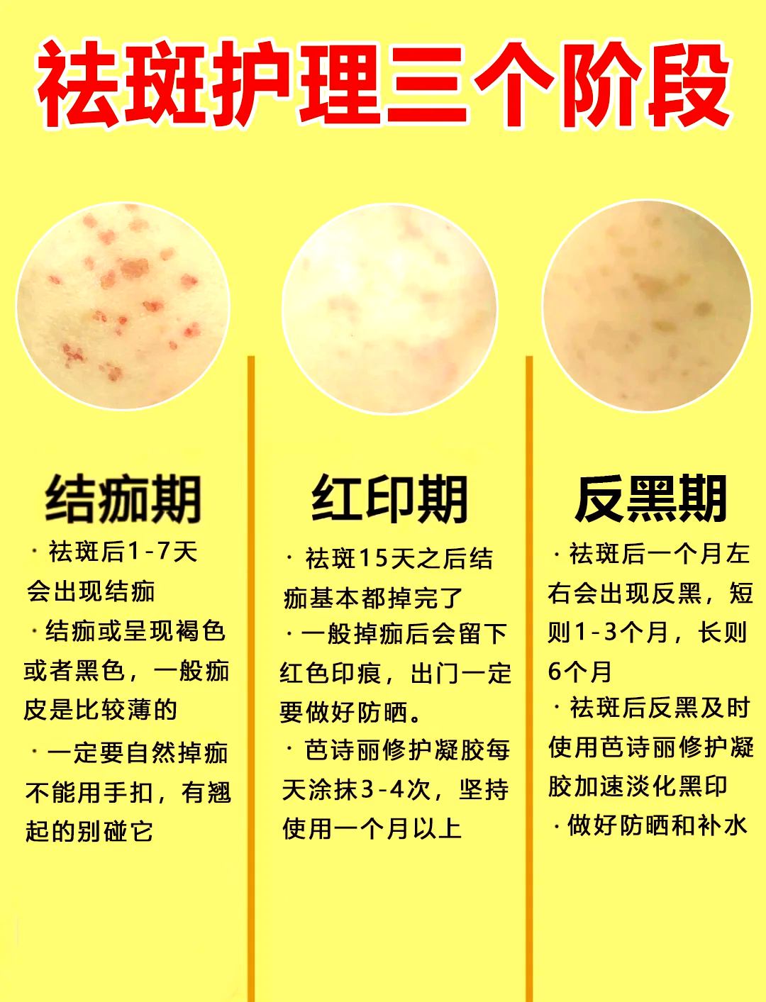 祛斑反黑期多久消失(祛斑反黑期是怎么回事)