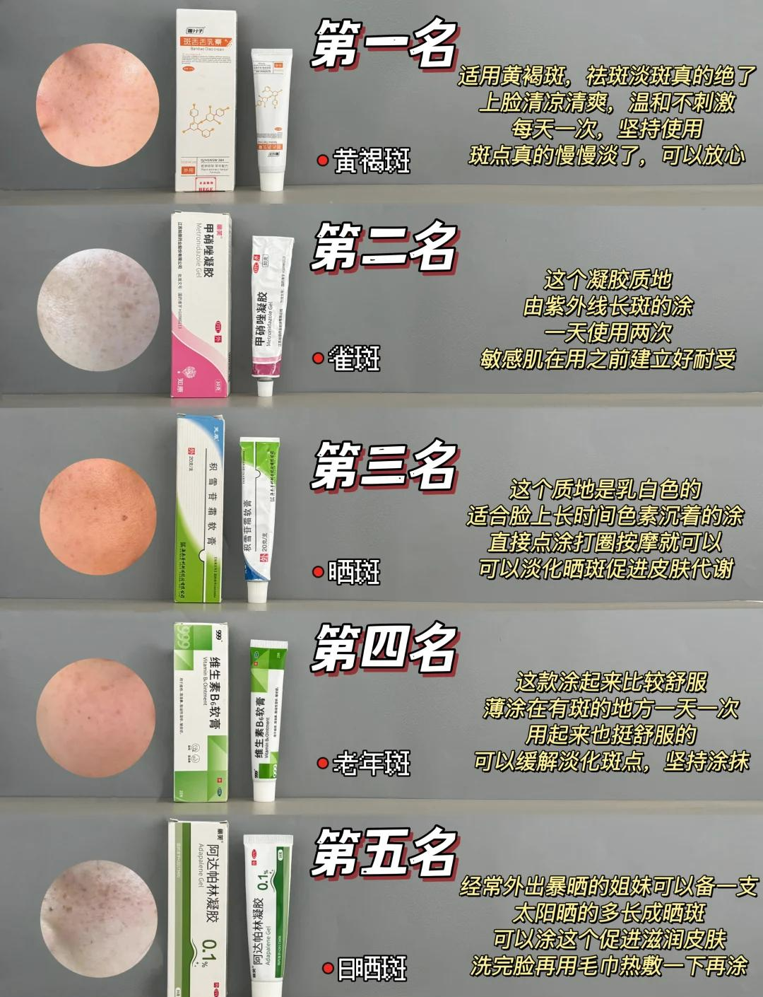 祛斑药膏哪个效果好(激光祛斑20天变化图片)