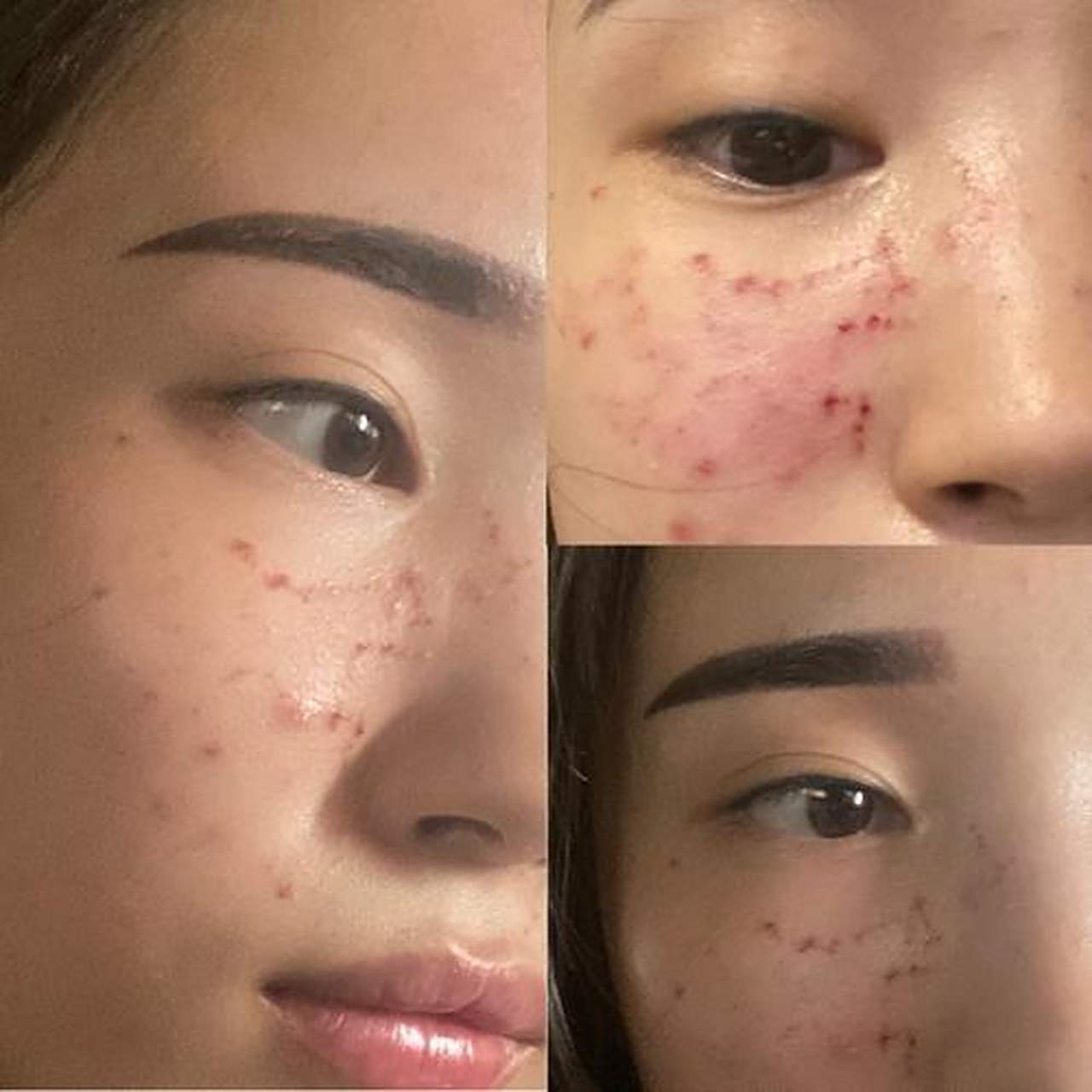 皮秒和激光哪个祛斑效果好(皮秒和激光哪个祛斑效果好一点)