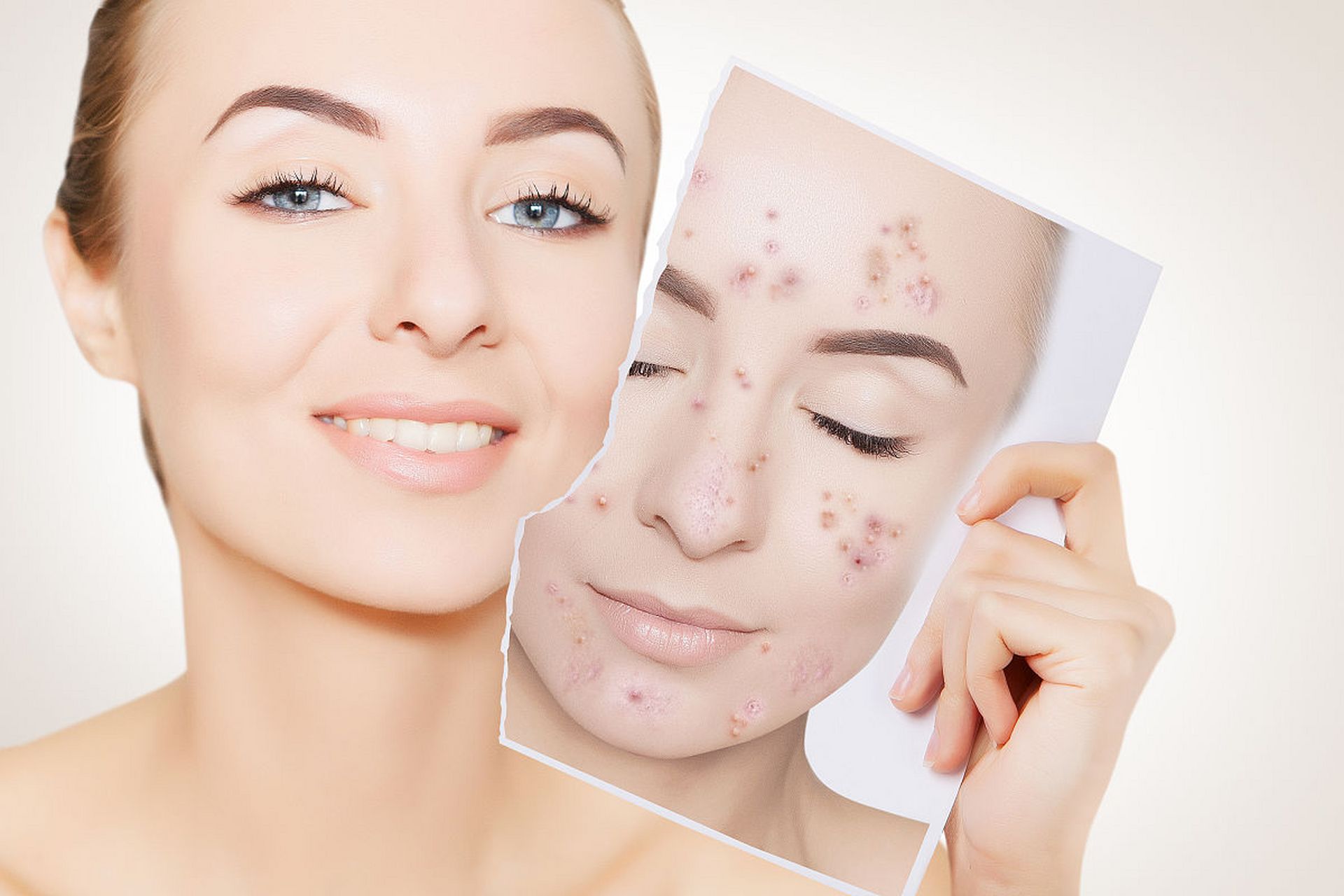 美容祛斑(美容祛斑针灸法)