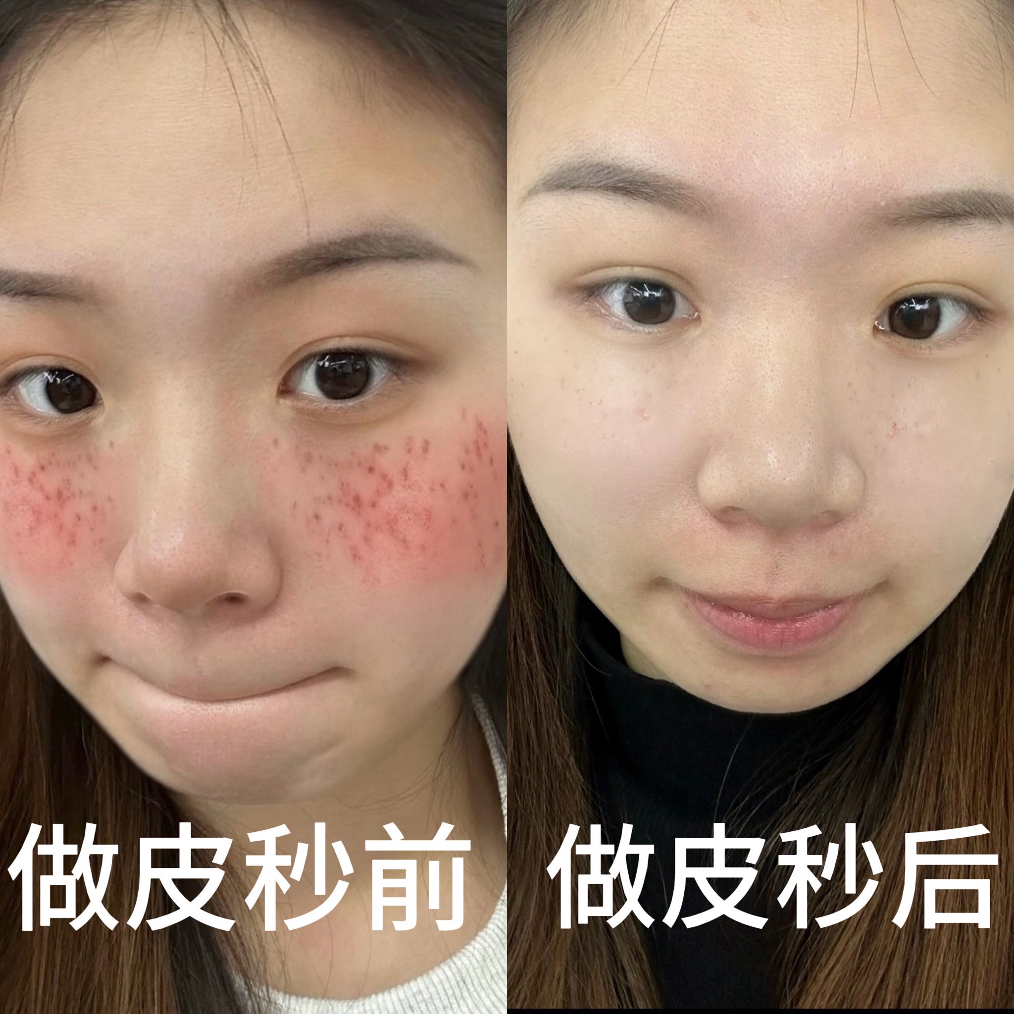 祛斑最有效的方法(真正祛斑最有效的方法)