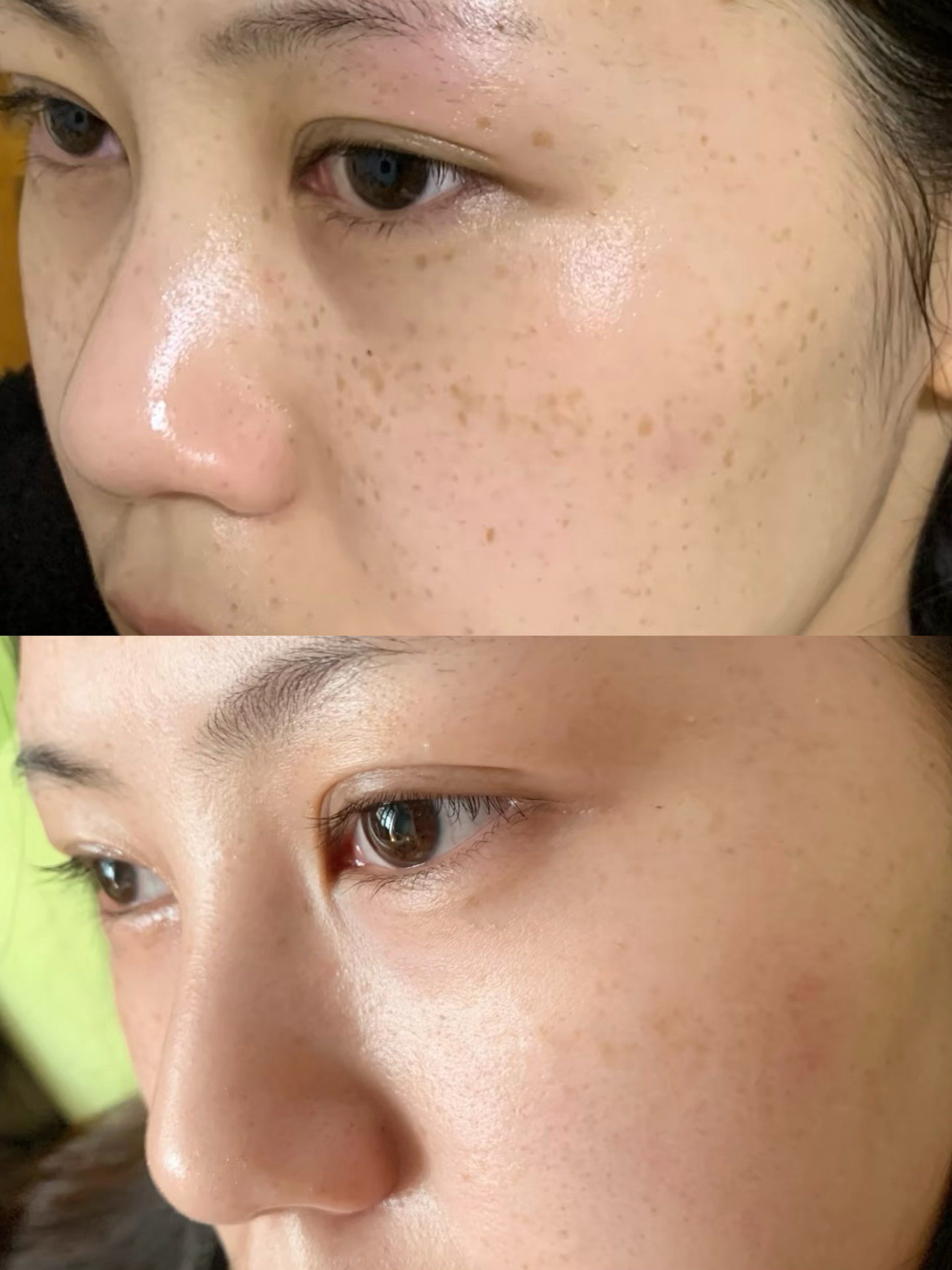 茶油涂脸祛斑多久见效(茶油可以淡斑是直接涂抹脸上吗)