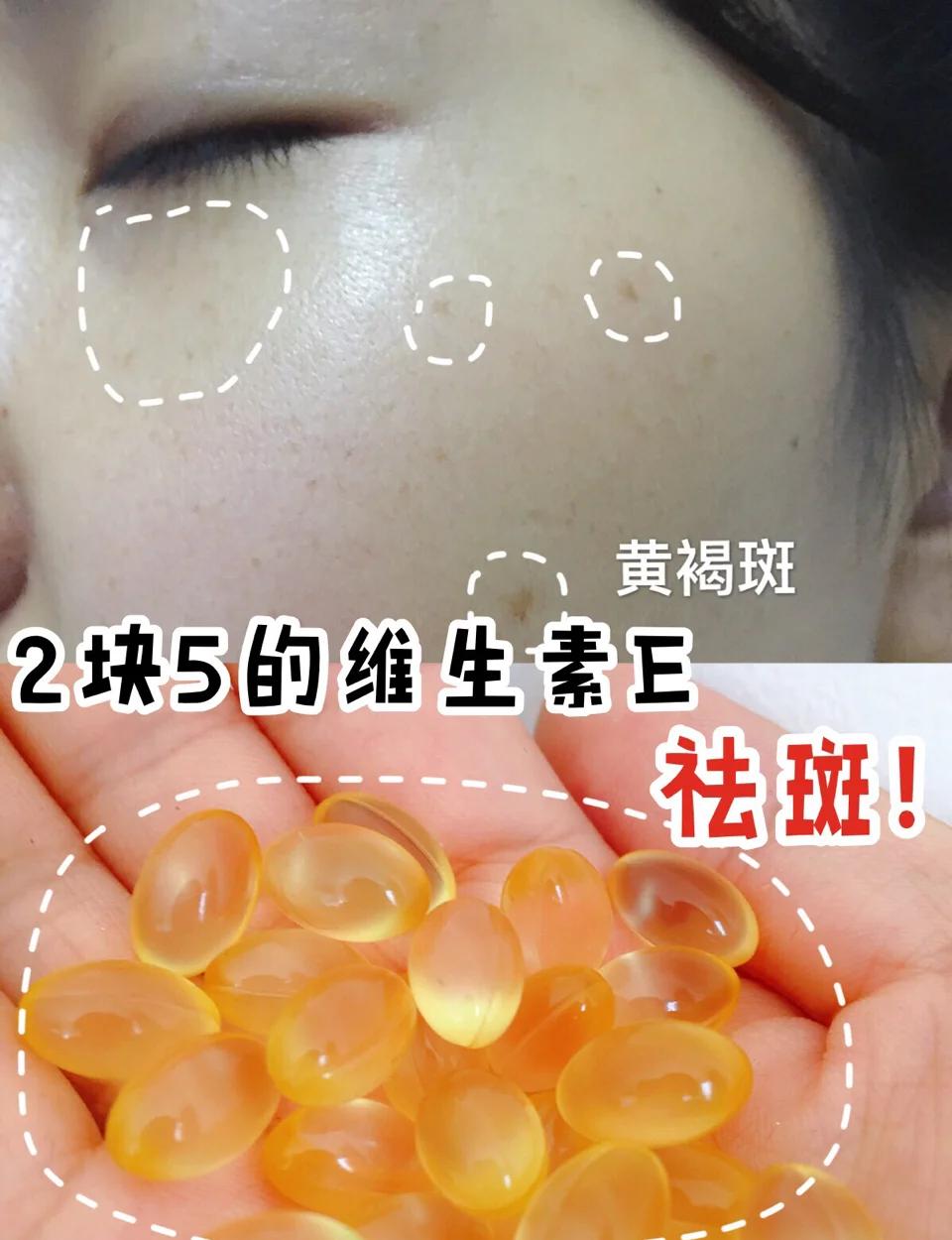 维生素c和e如何祛斑(50岁每天吃一粒维生素e的好处)