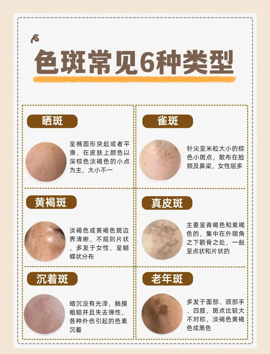 脸上如何祛斑(脸上怎么祛斑最有效的方法)