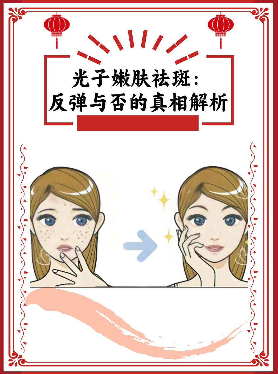 激光祛斑会反弹吗(激光祛斑好吗 激光祛斑会反弹吗)