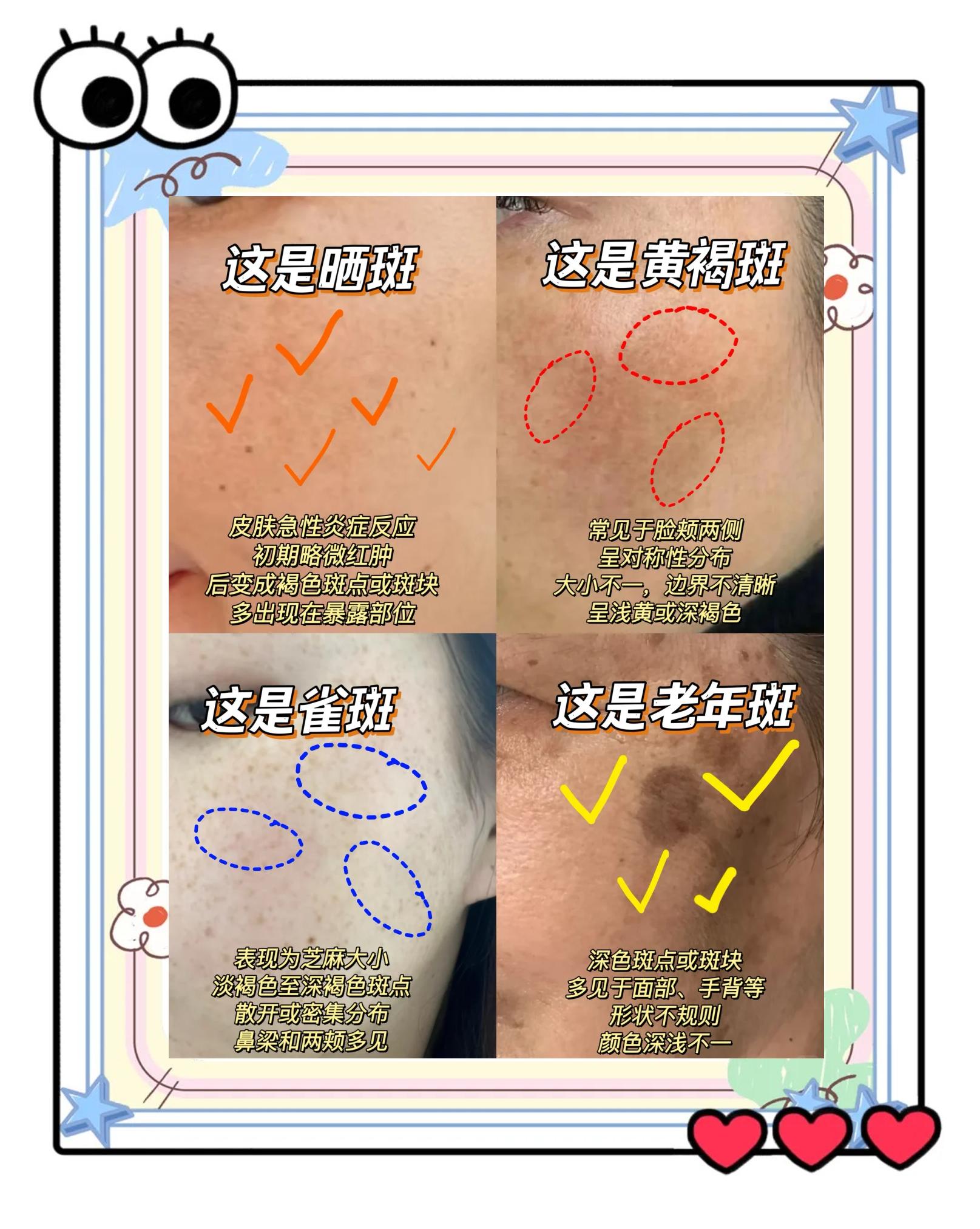 医院可以祛斑吗(医院可以祛斑吗挂什么科)