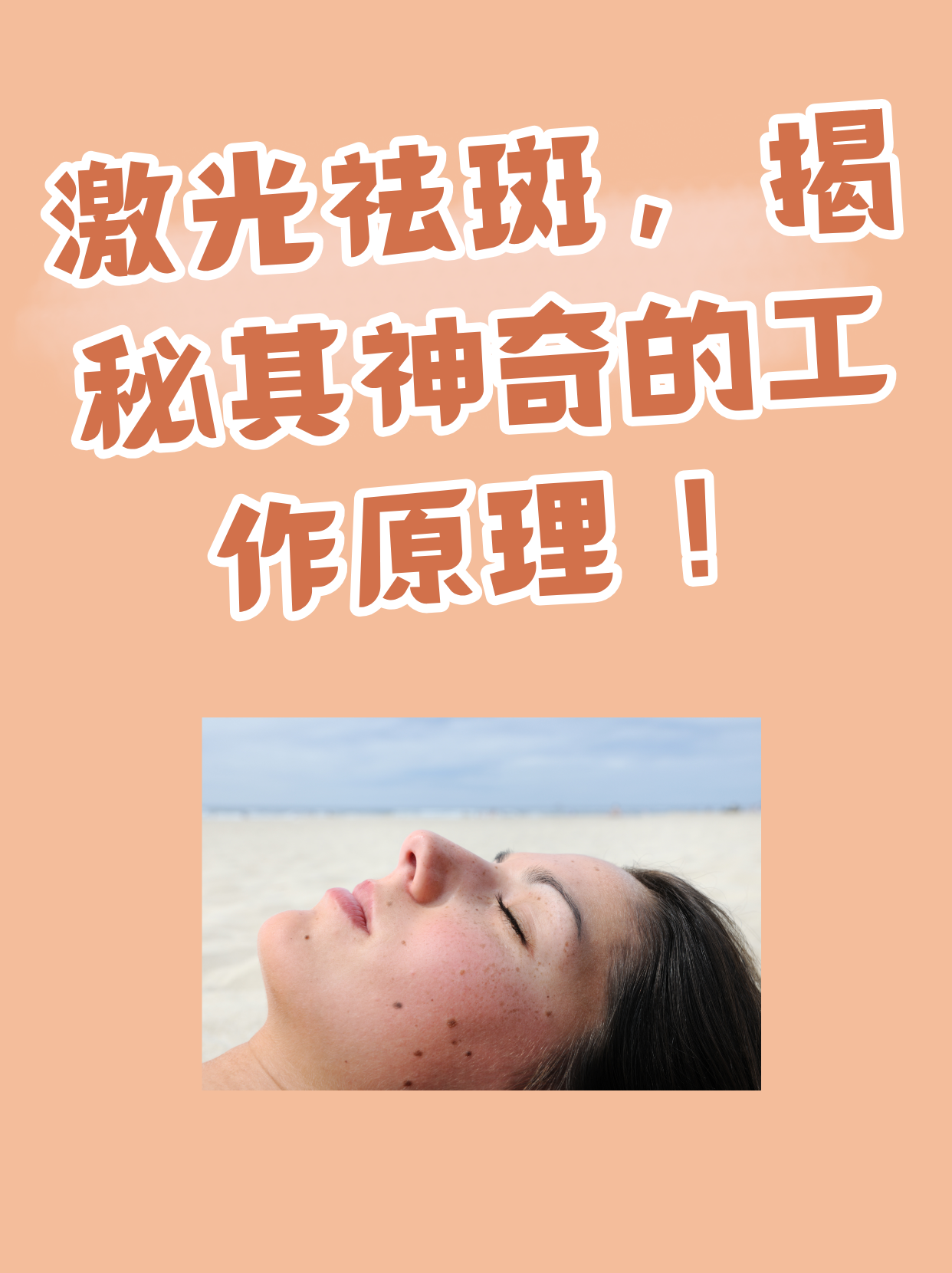 祛斑激光(祛斑激光多少钱一次)