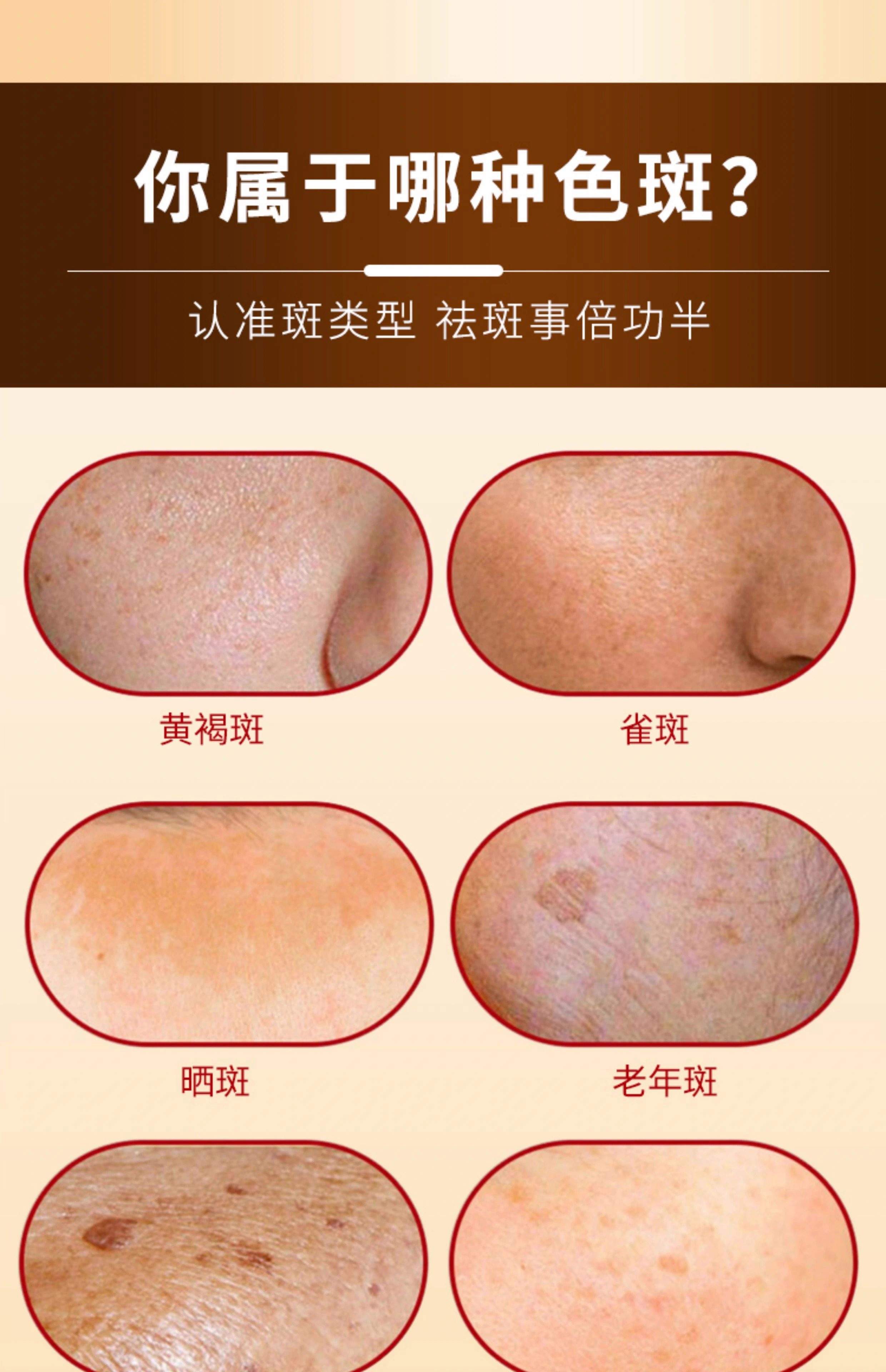 美白祛斑方法(美白祛斑超简单方法)