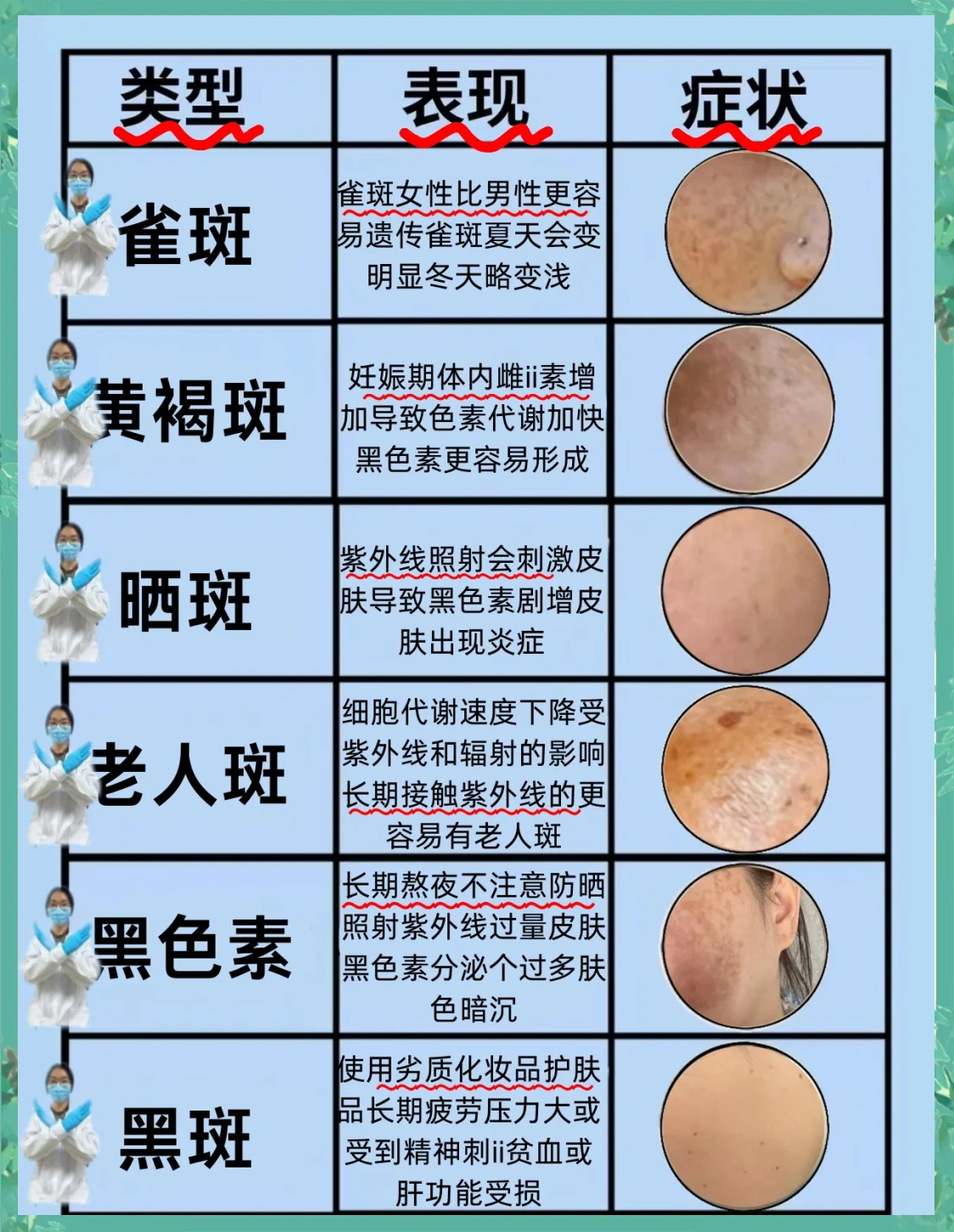 祛斑多少钱(c10激光祛斑多少钱)