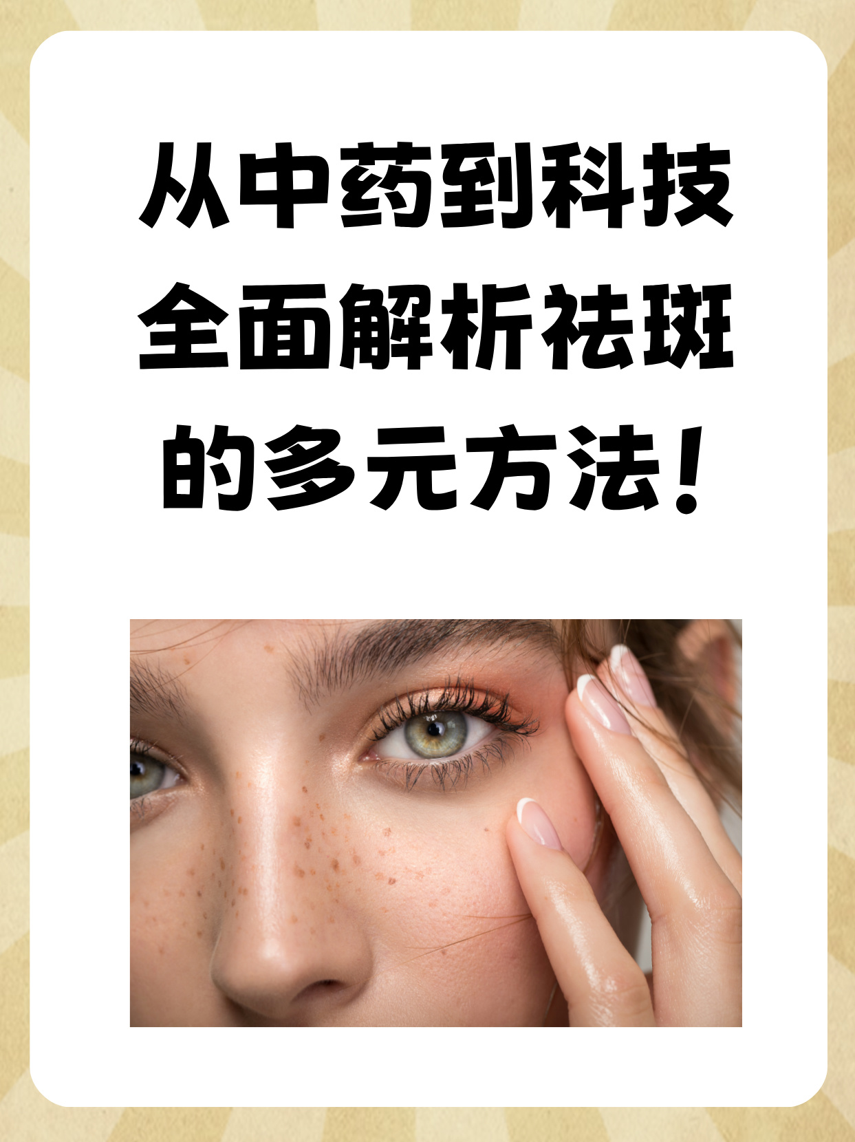 祛斑技术(祛斑技术有哪几种)