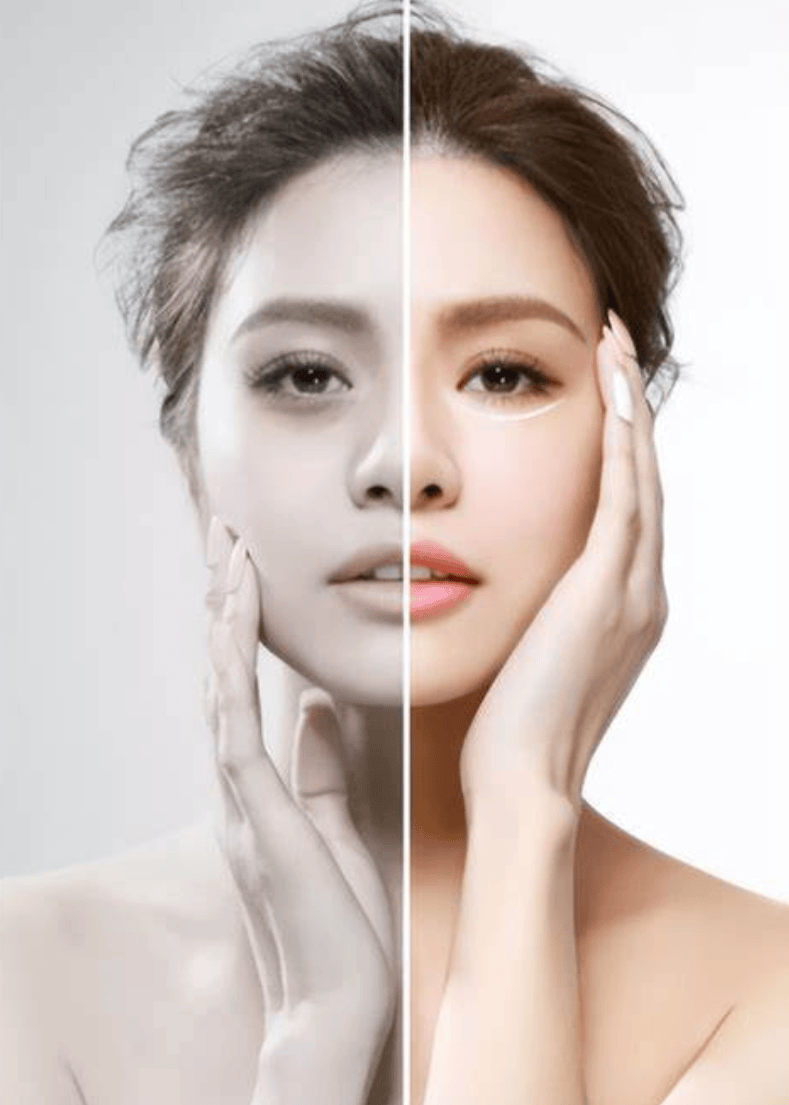 医美祛斑(医美祛斑真的能去掉吗)