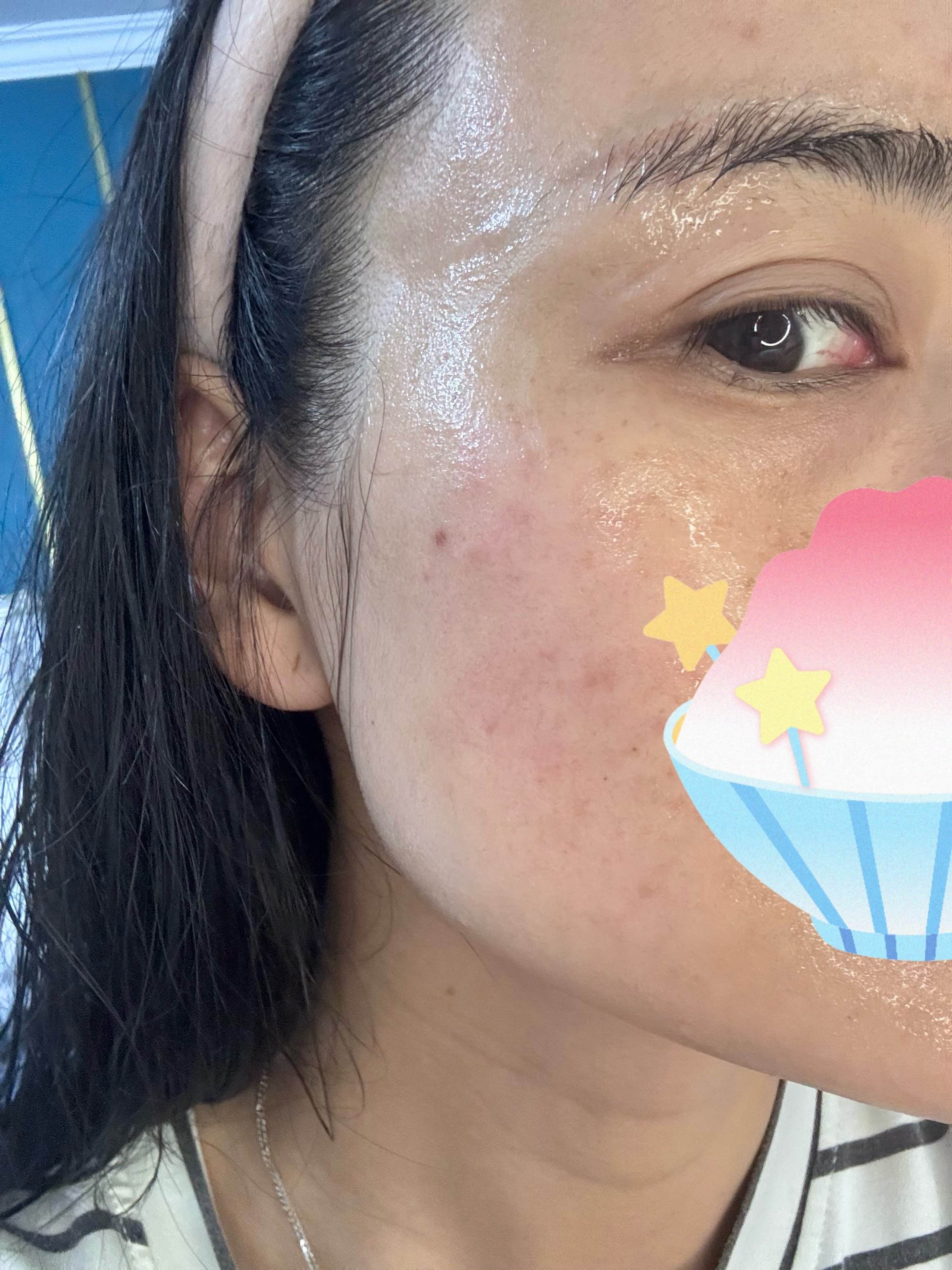 祛斑面膜(祛斑面膜能去掉斑吗)