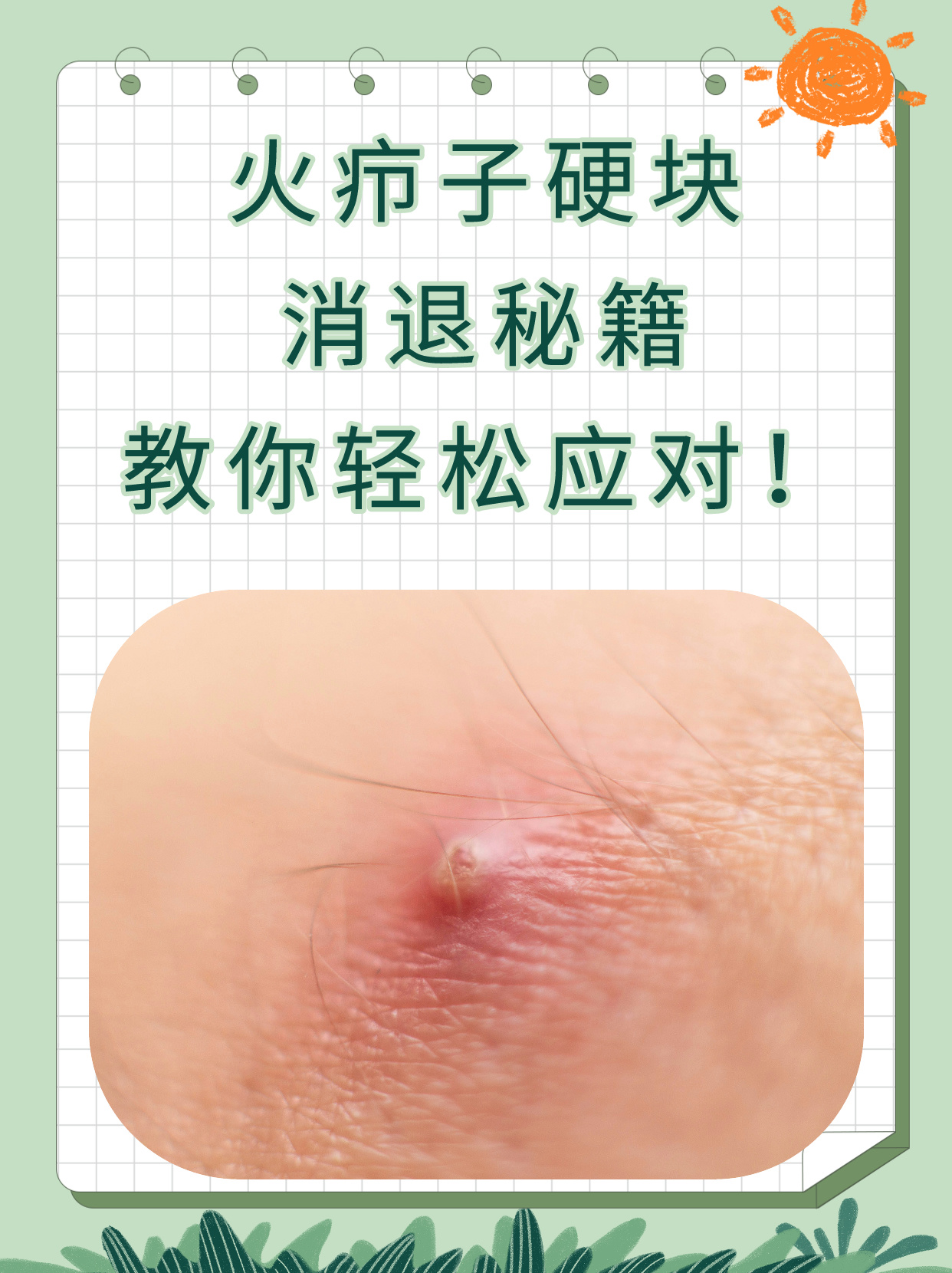 硬块痘痘怎么快速消除(硬块痘痘怎么快速消除不疼)