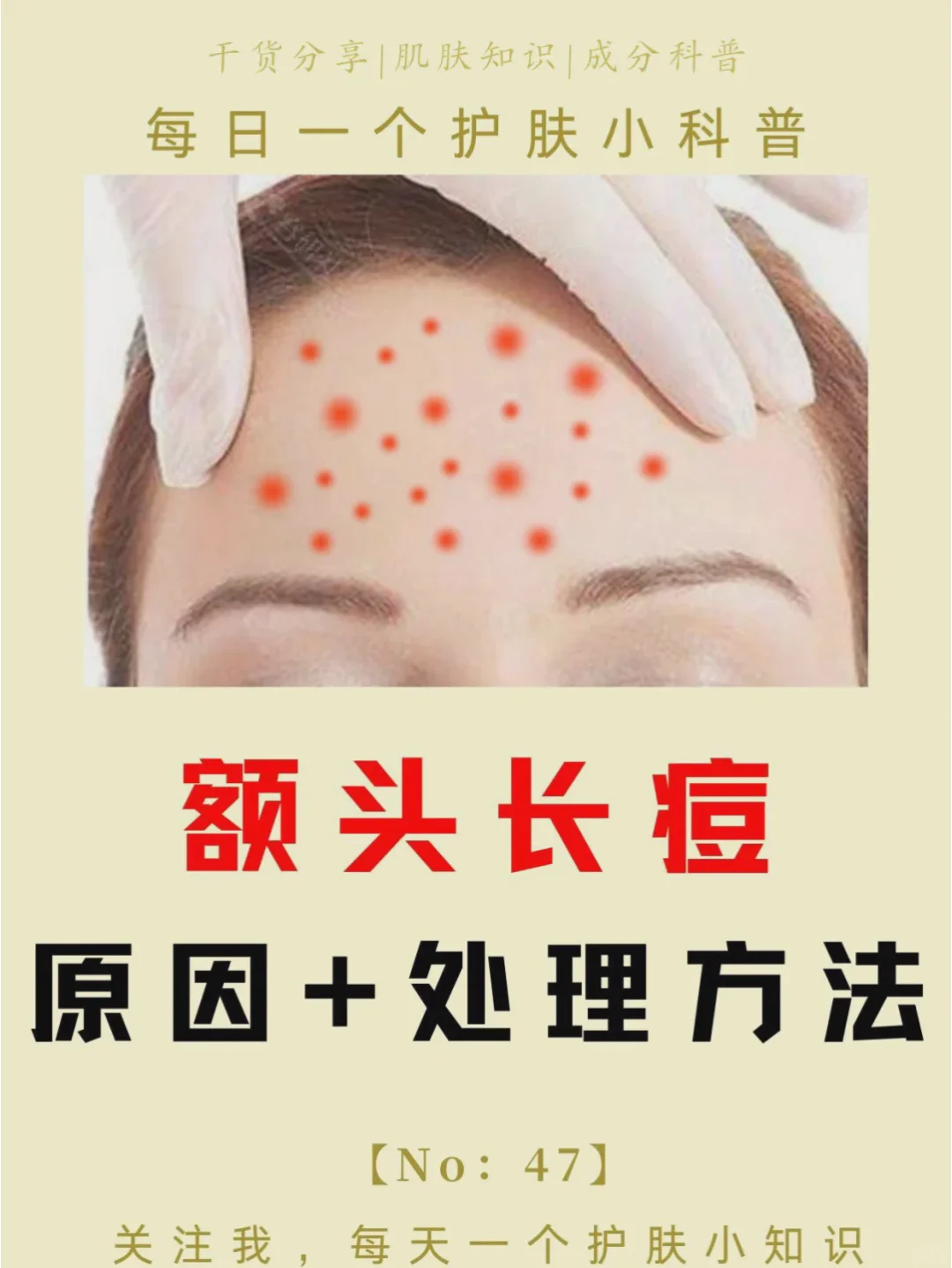 头上长痘痘是什么原因(女孩子额头上长痘痘是什么原因)