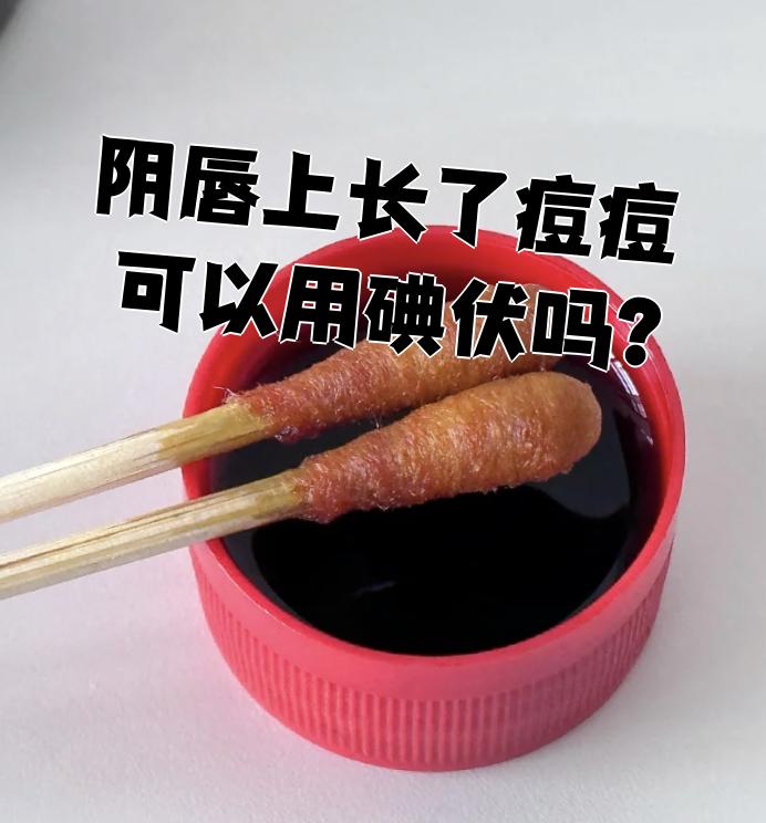 碘伏可以涂在痘痘上吗(碘伏可以擦在痘痘上消炎吗)