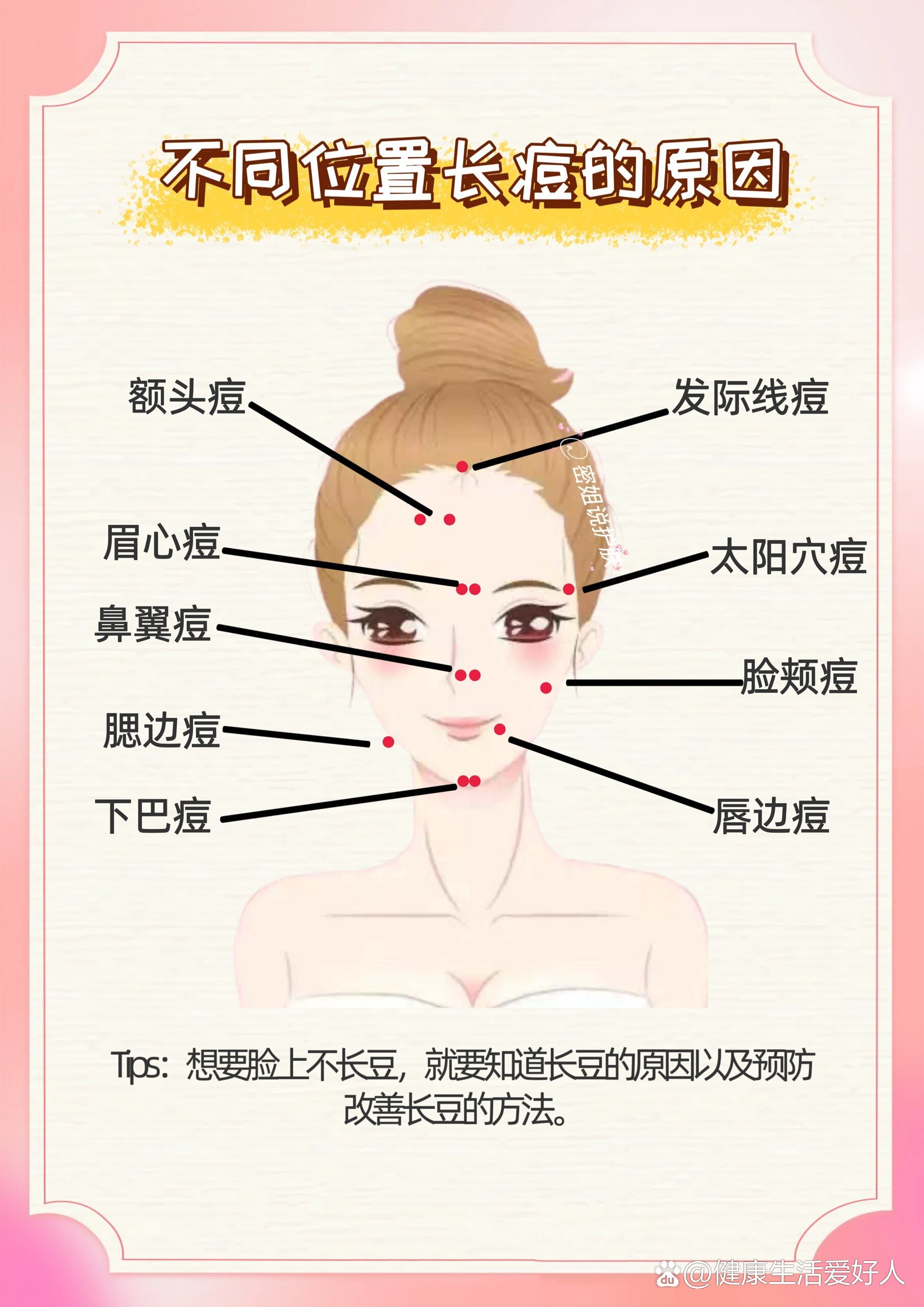 脸上长痘痘的位置(脸上长痘痘的位置代表)