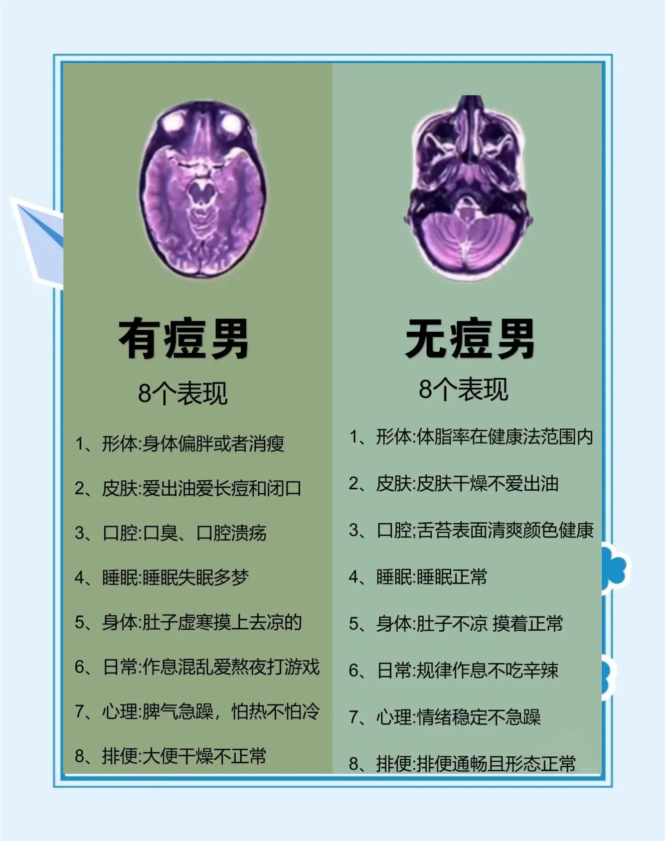 鬓角长痘痘是什么原因(两边鬓角长痘痘是什么原因)