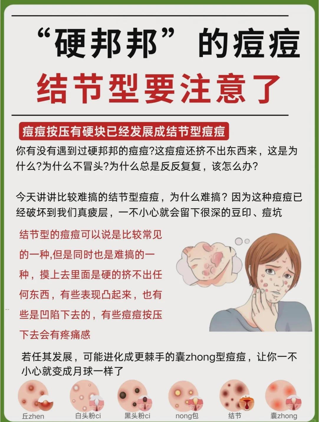 痘痘怎么快速消除(鼻子两侧长痘痘怎么快速消除)