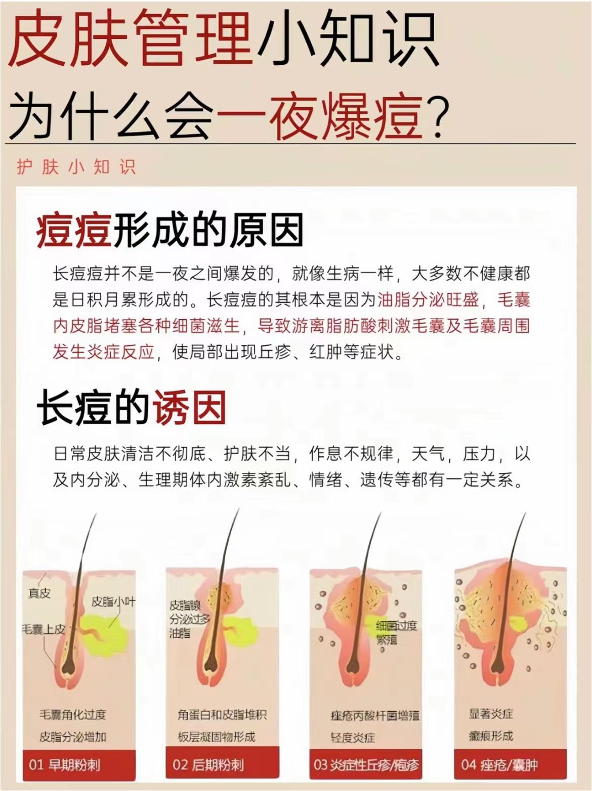 痘痘怎么快速消除(鼻子两侧长痘痘怎么快速消除)